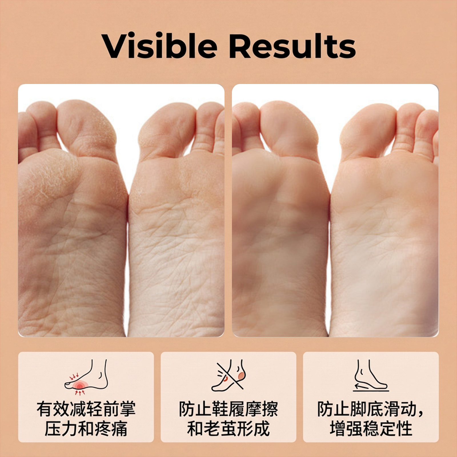 (Black) High Heel Forefoot Pad Soft Comfortable AntiSlip AntiShift Firm Light Portable Thin Refreshing SkinFriendly Washable