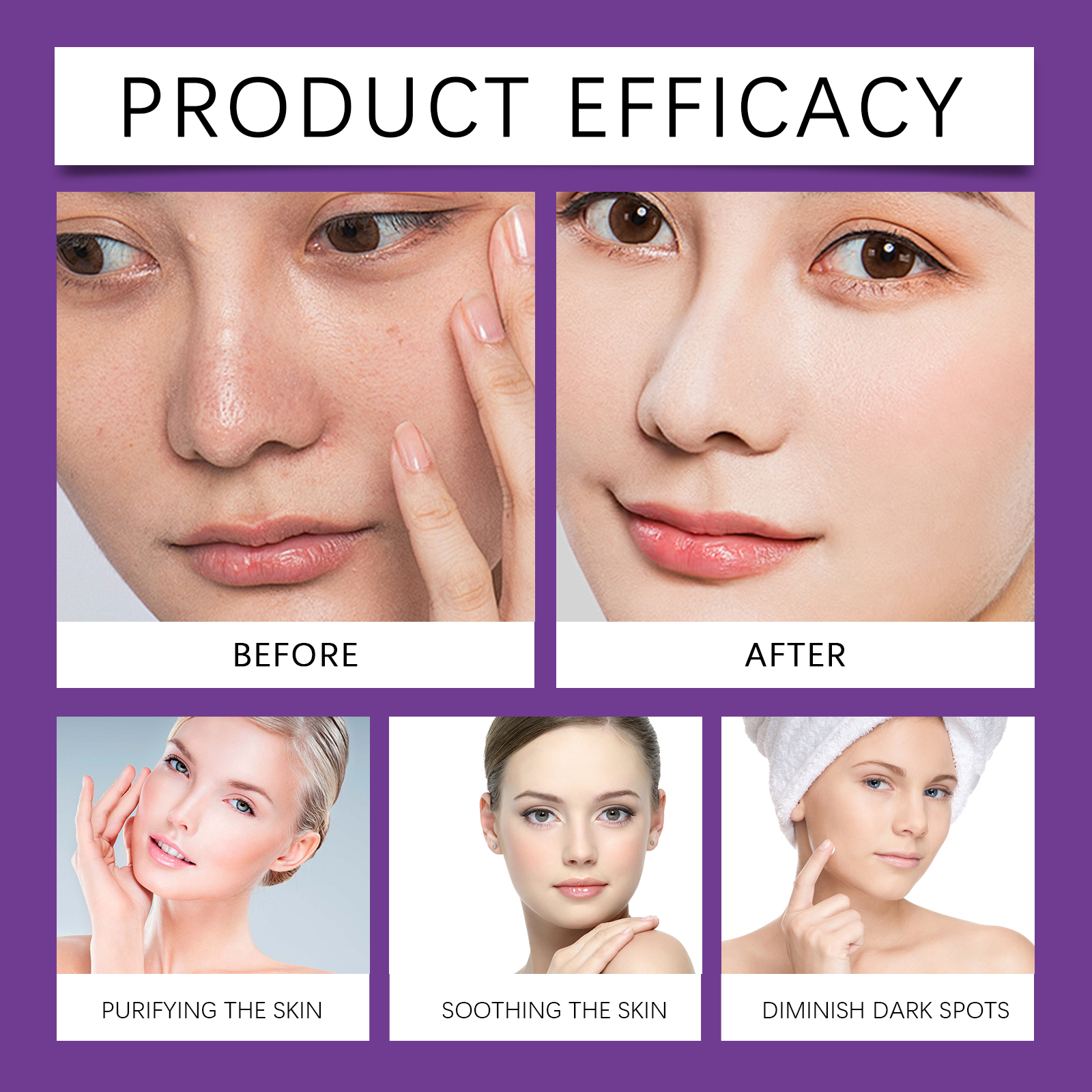 Azelaic Acid Repairing Cream Gentle Repair For Facial Skin Cleansing Daily Care Moisturizer