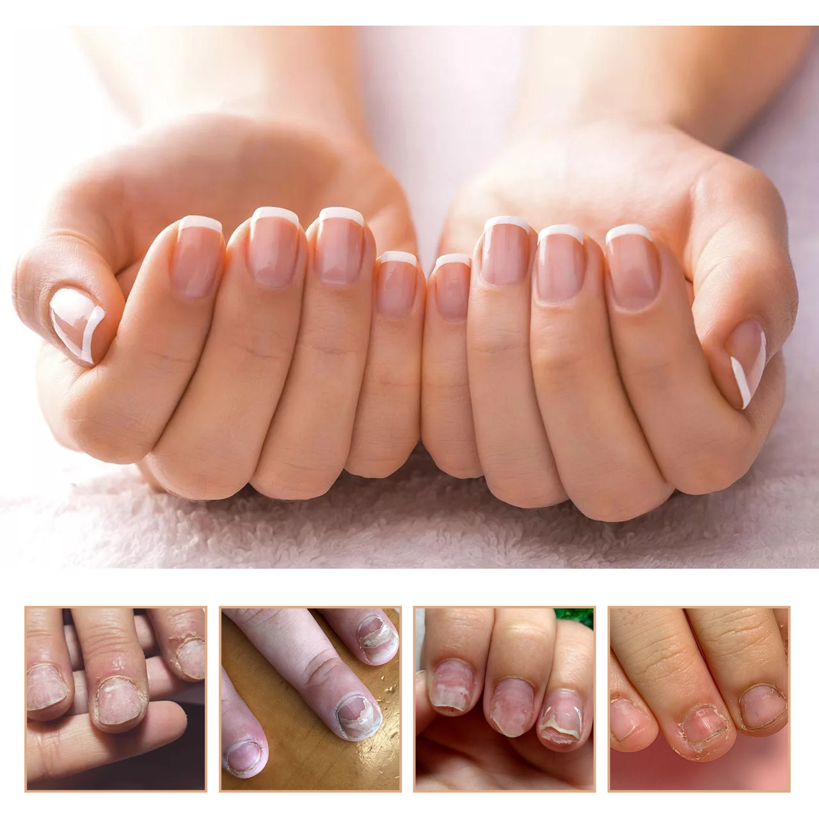 Nail Care Cream Moisturizing Softening Brightening For Fingernails And Toenails Daily Home Manicure Treatment