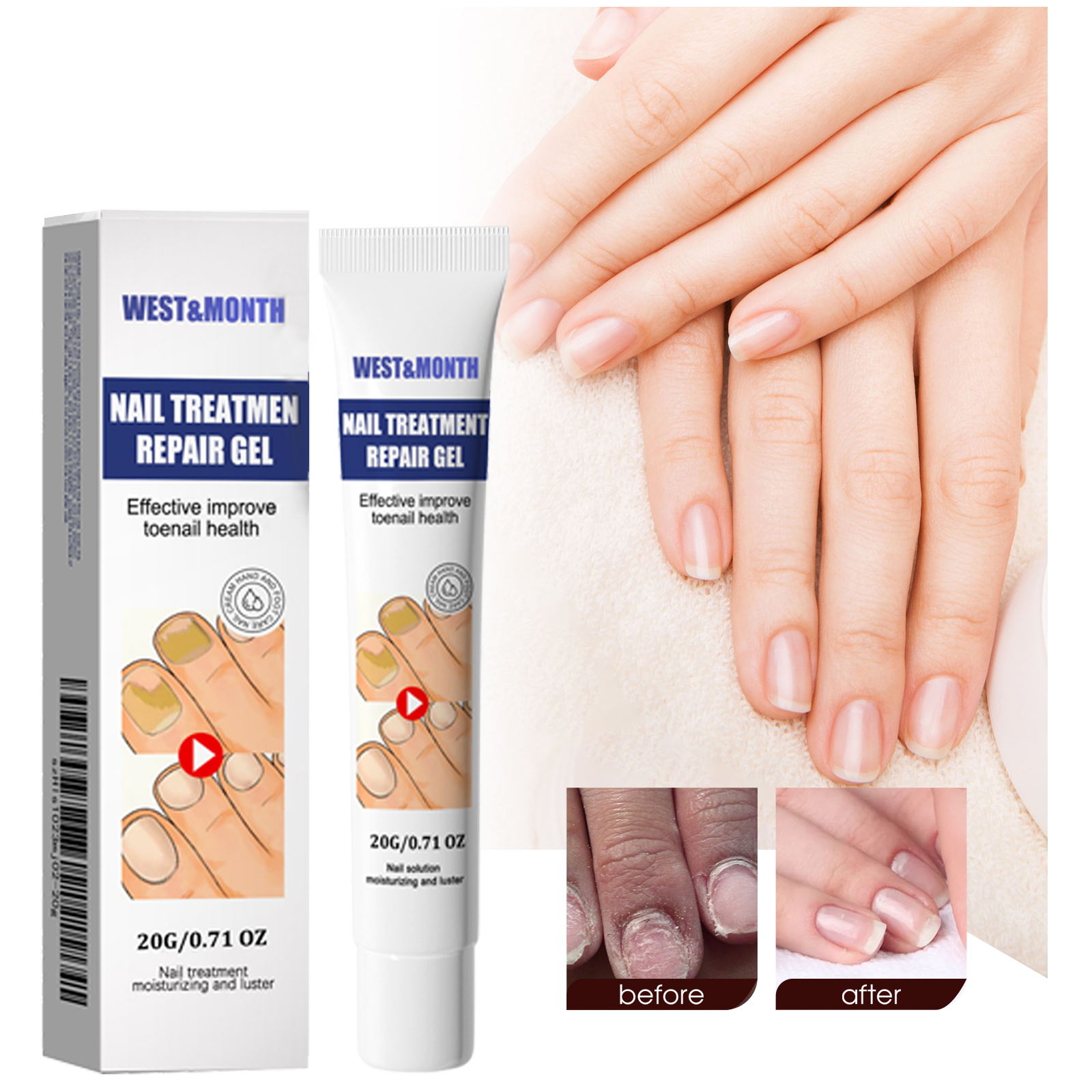 Nail Care Cream Moisturizing Softening Brightening For Fingernails And Toenails Daily Home Manicure Treatment