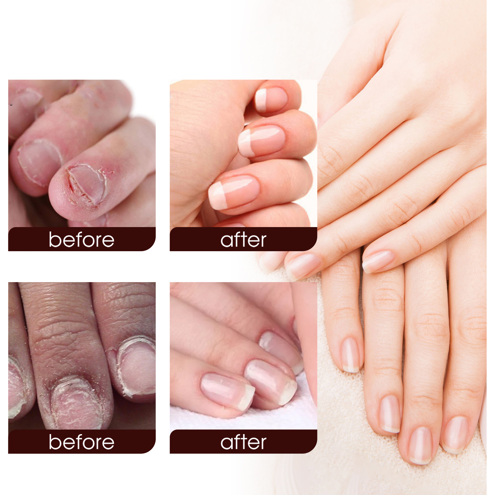 Nail Care Cream Moisturizing Softening Brightening For Fingernails And Toenails Daily Home Manicure Treatment