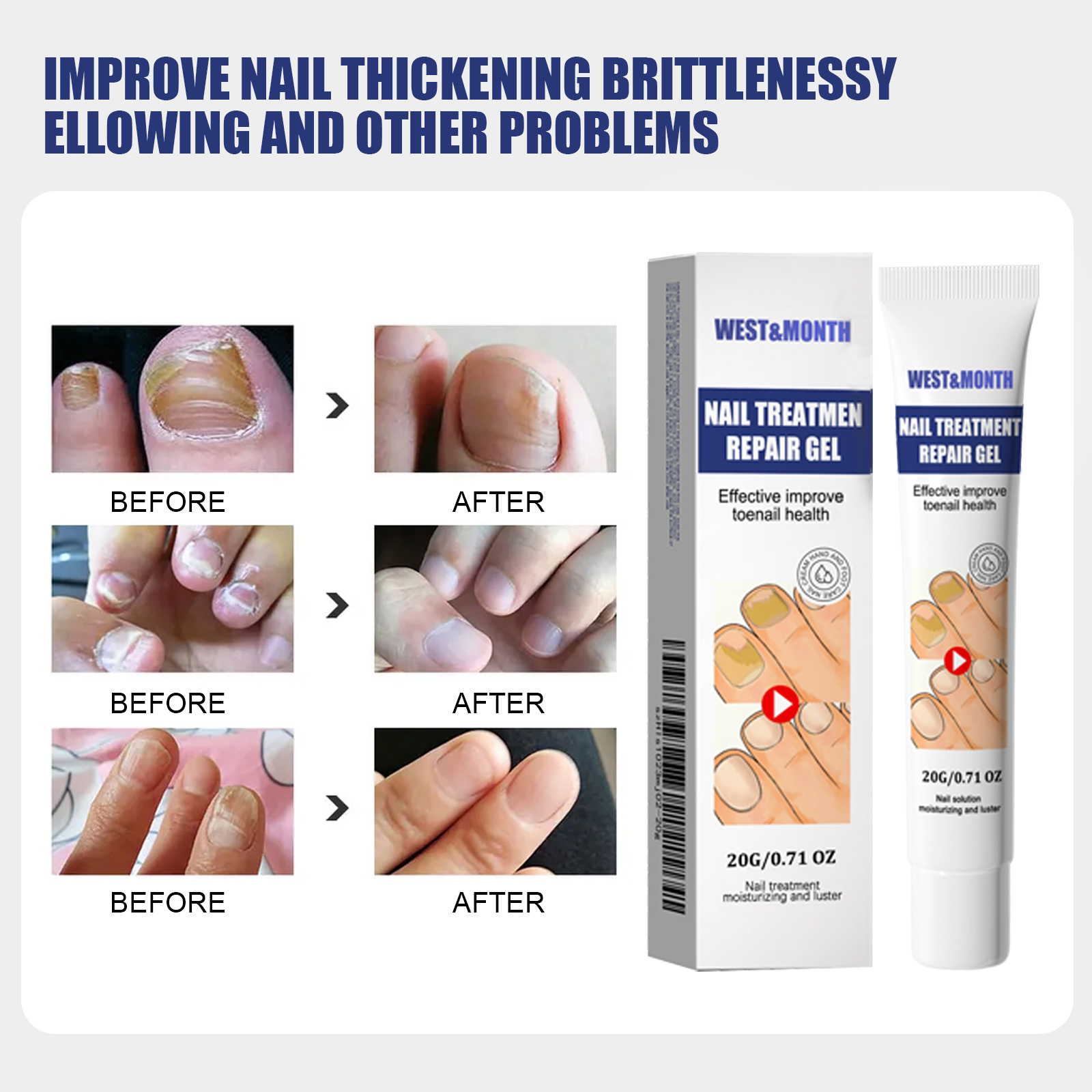 Nail Care Cream Moisturizing Softening Brightening For Fingernails And Toenails Daily Home Manicure Treatment