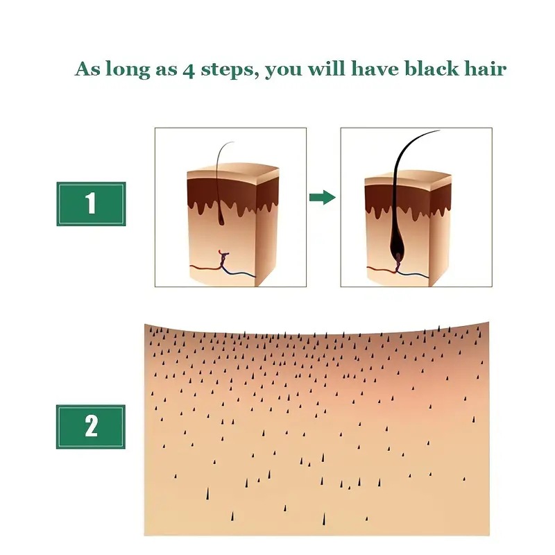 SUAI Hair Essential Oil Ginger Anti Hair Loss Repair Care Nourish Hair Growth Products