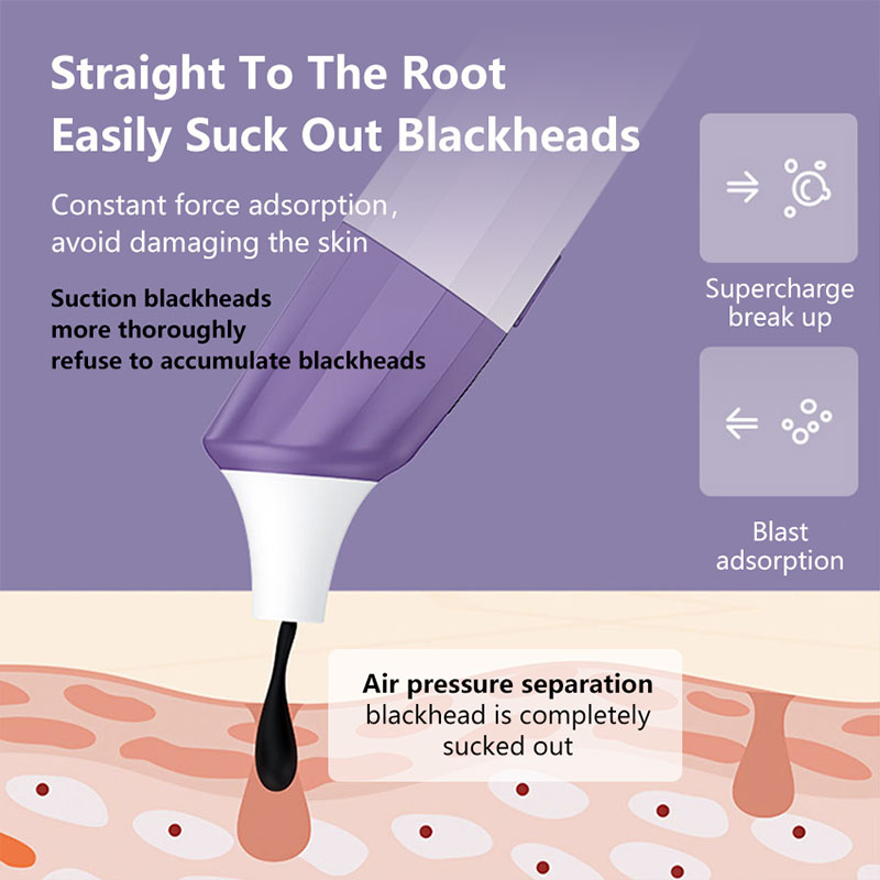 (Green) Visual Blackhead Remover Home Beauty Instrument Pore Deep Cleaner Vacuum Silicone Suction Head Cleansing Instrument APP HD Camera Function