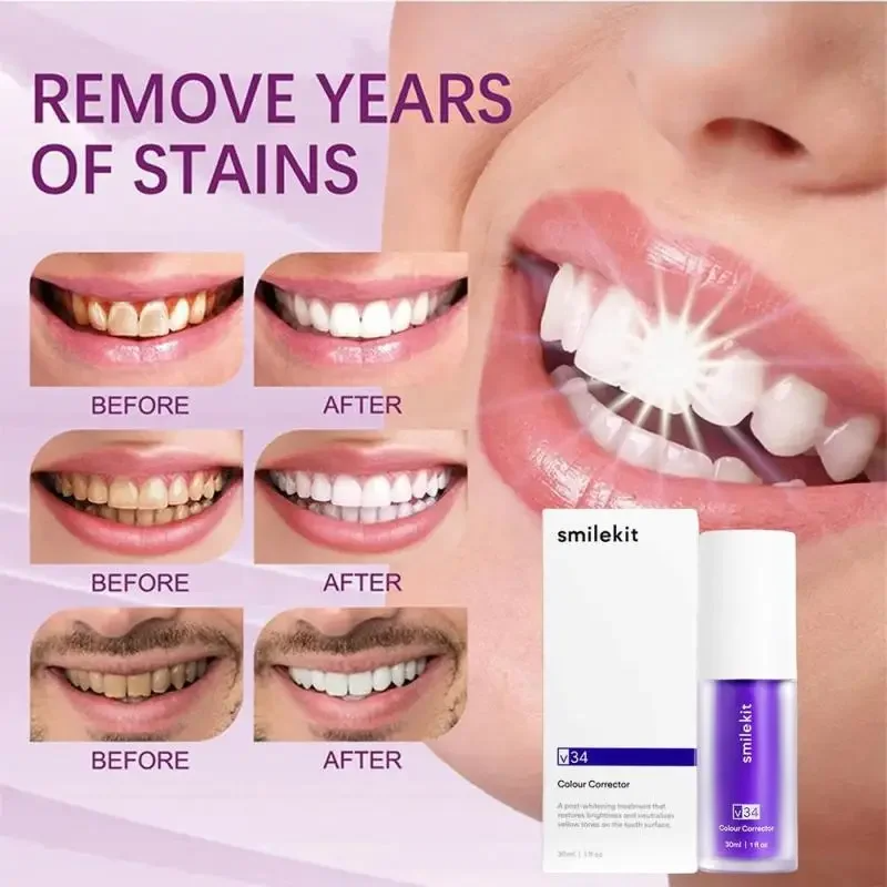 SMILEKIT V34 Purple Whitening Toothpaste Remove Smoke Stain Tartar Reduce Yellowing Care For Teeth Gums Fresh Breath Clean Oral Hygiene Teeth Care 30ml