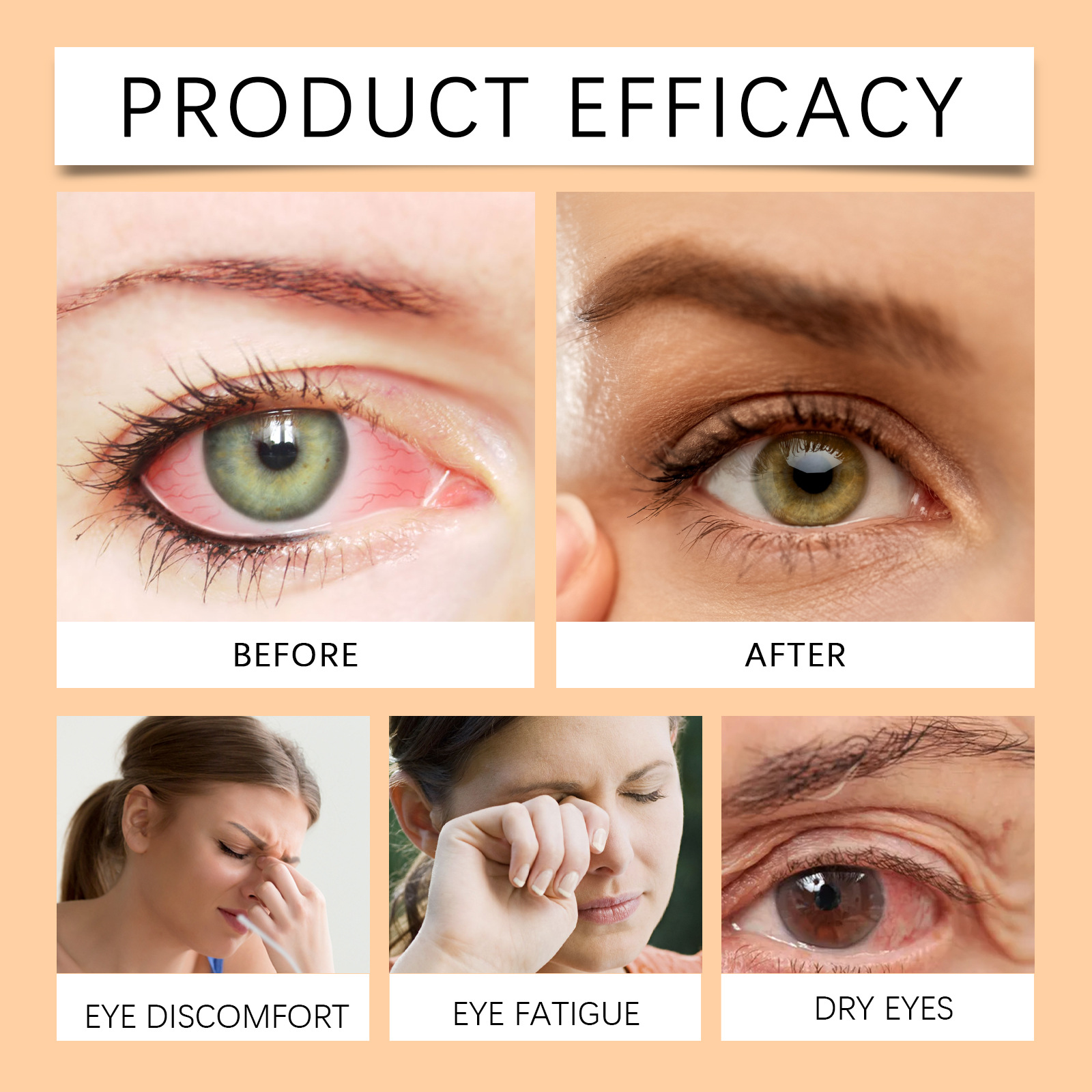 (1 PC) Eye Care Solution Bee Honey Eye Drops Fatigue Dry Eyes Astigmatism Blurred Vision Reliever Refreshing Moisturizing Improve Eyesight Soothing Eye Care Products