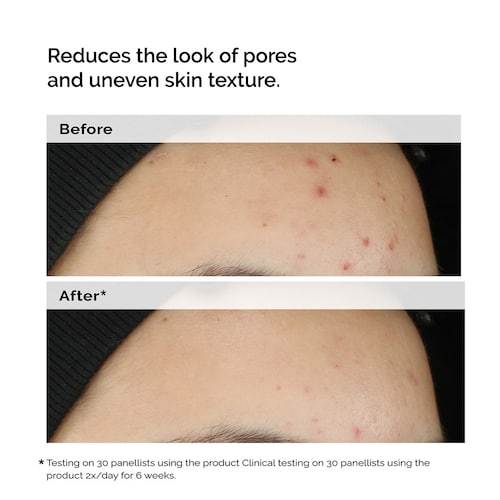 The Ordinary Balancing Clarifying Serum for Blemish Prone Skin 30ml