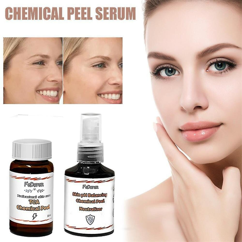 Tca 30 Percents  Tca Peel Acid Peeling Acid Skin Superforce Peeling Pigmentation Acne Scar