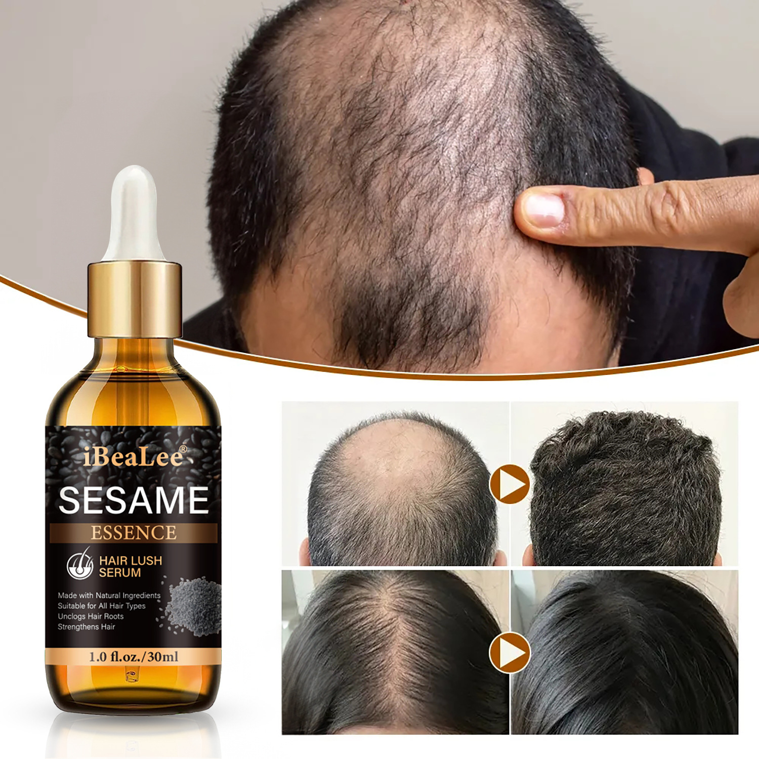 Black Sesame Hair Growth Essence Strengthening and Moisturizing Hair Root Repair Improves Anti Hair Loss and Hair Retention Dense Hair Essential Oil 30ml