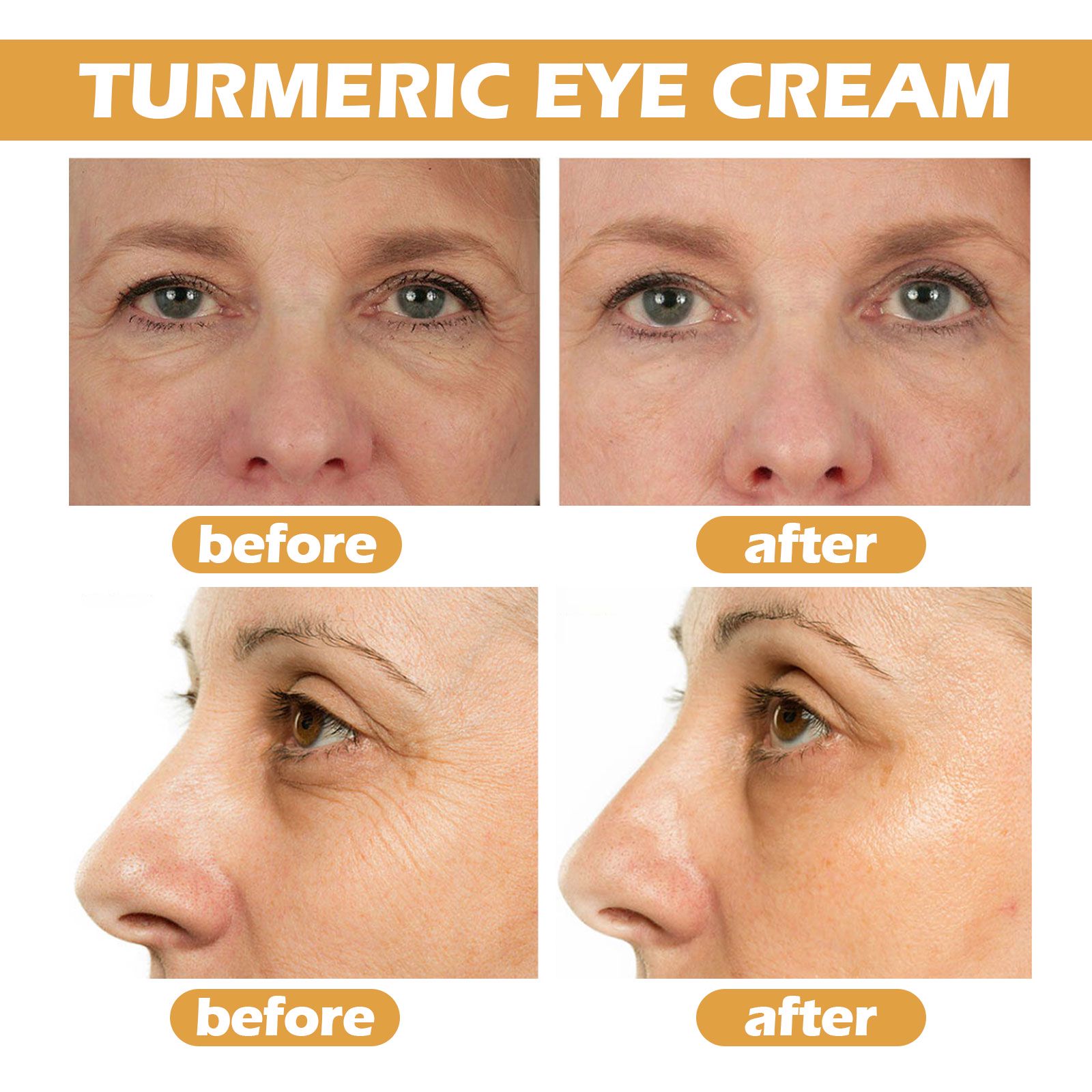 Turmeric Eye Cream Brightening For Dark Circles Puffiness And Fine Lines Daily Care