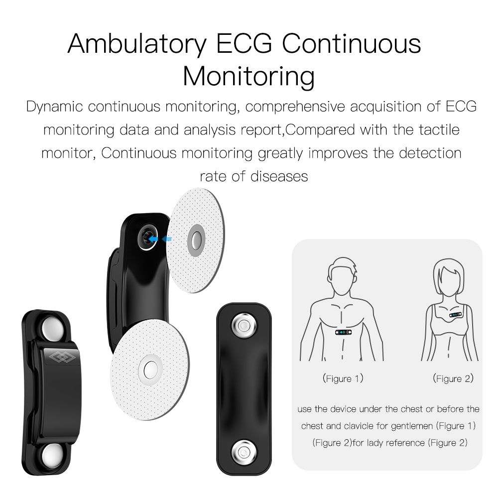 (Blue) 24-hour Dynamic ECG Monitoring Smart Tracker Super Precision Lorentz Diagram Smart Watch For Men Women