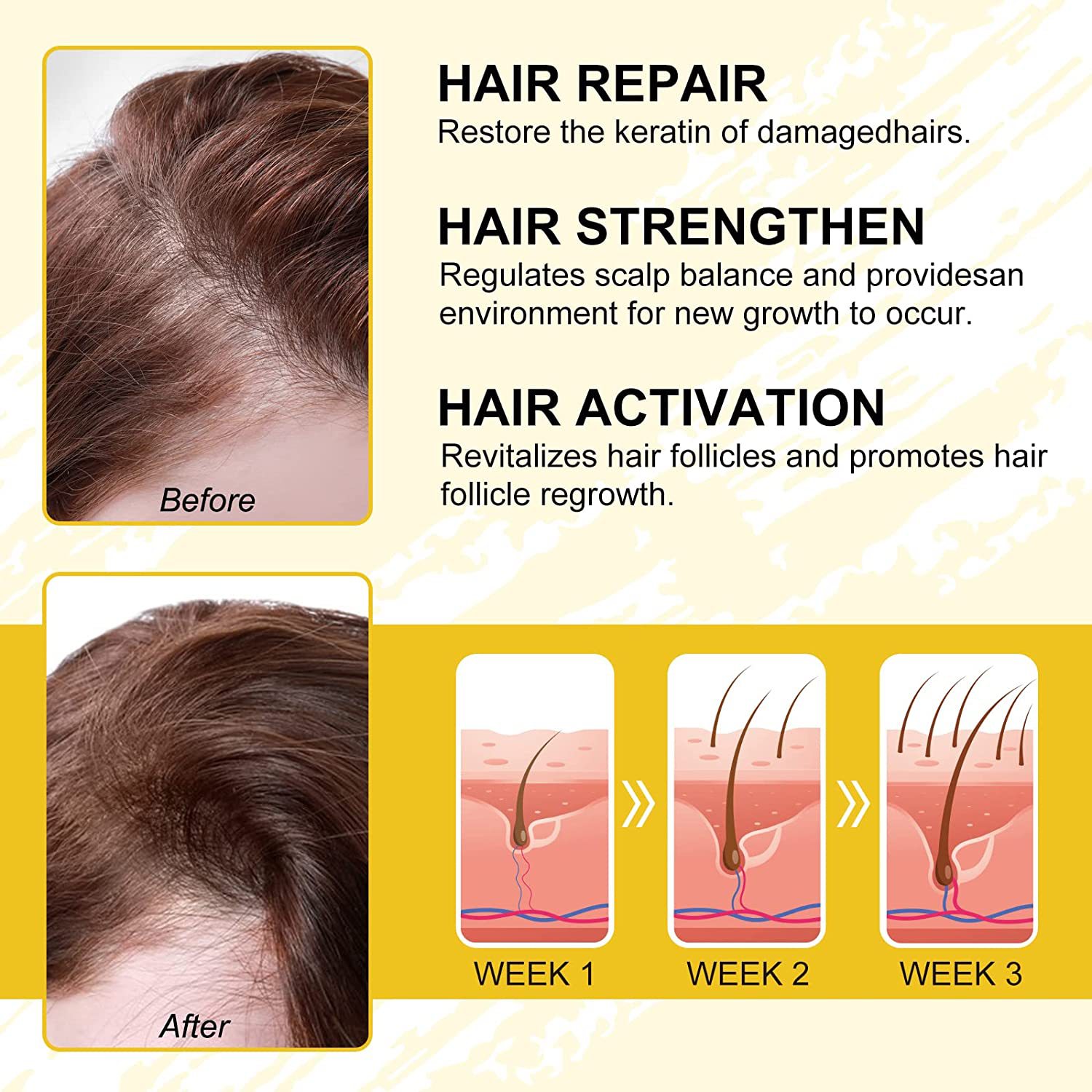 iBeaLee Hair Growth Serum Rice Water for Hair Growth Hair Loss Scalp Treatments Nourish Hair Care for Thicker Longer Fuller Healthier Hair