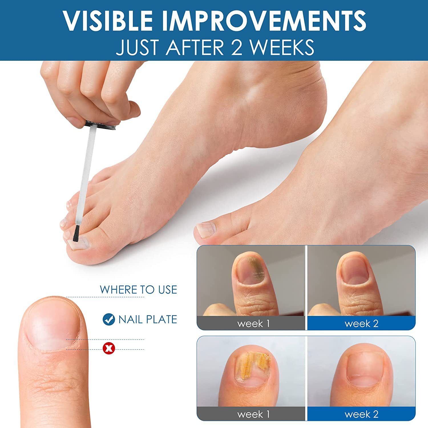 iBeaLee Nail Fungus Treatment Onychomycosis Repair Liquid Anti-Infective Oil Essence Serum Hand And Foot Care Supplies for Men Women 20ml