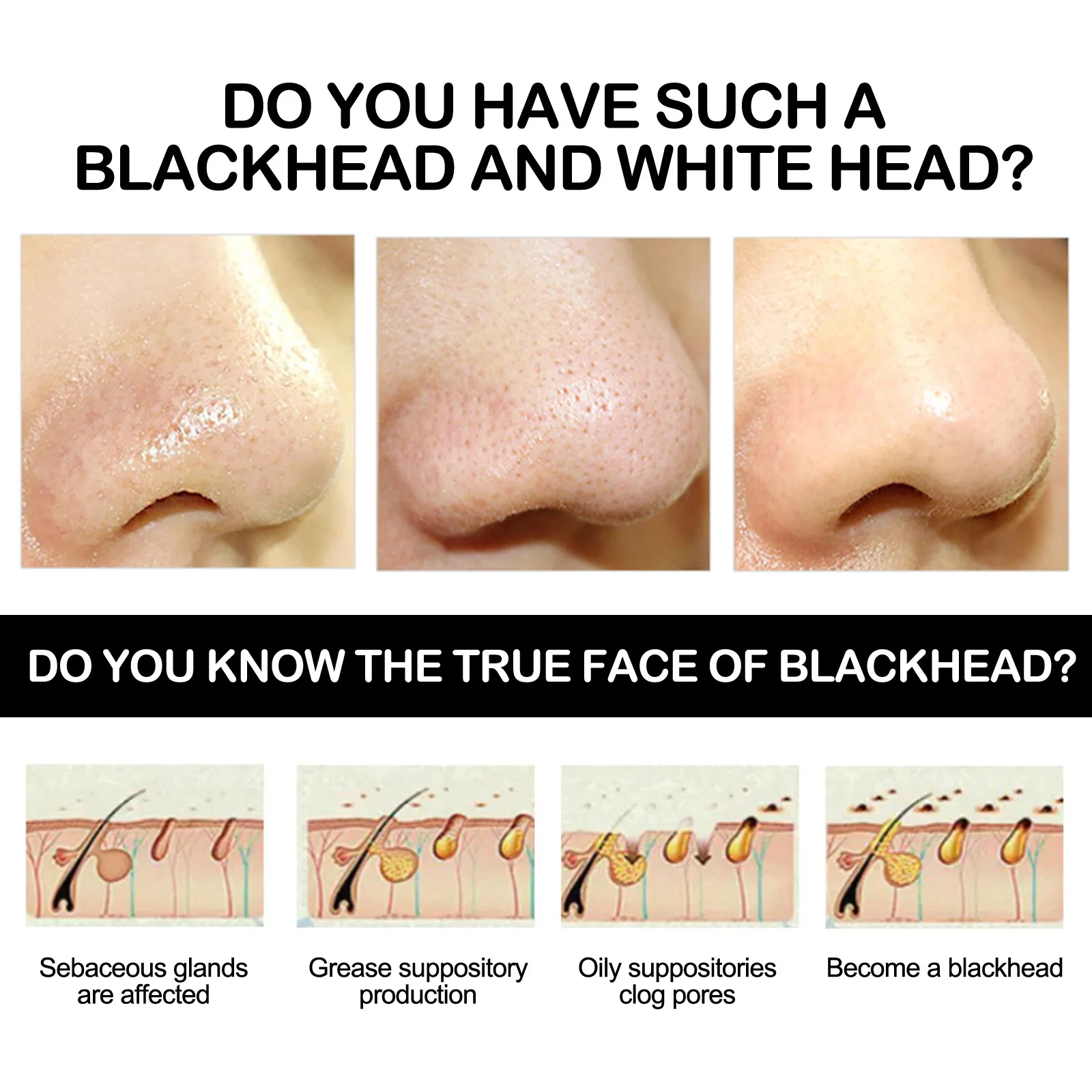 (1 PC) Blackhead Remover Bamboo Charcoal Cleansing Mask Remove Blackhead Shrink Pores Acne Treatment Oil Control Moisturizing Deeply Cleansing Mud Film Skin Care