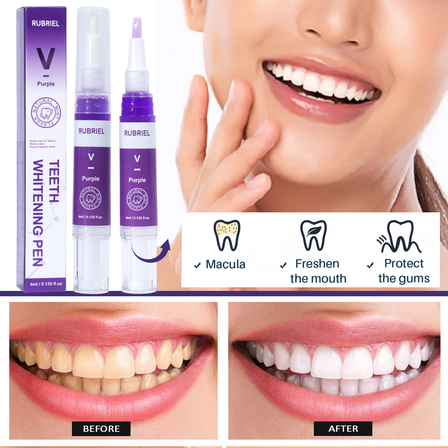 Teeth Whitening Pen For Stain Removal And Breath Freshening Daily Oral Care Travel Portable Whitening Tool 1pc