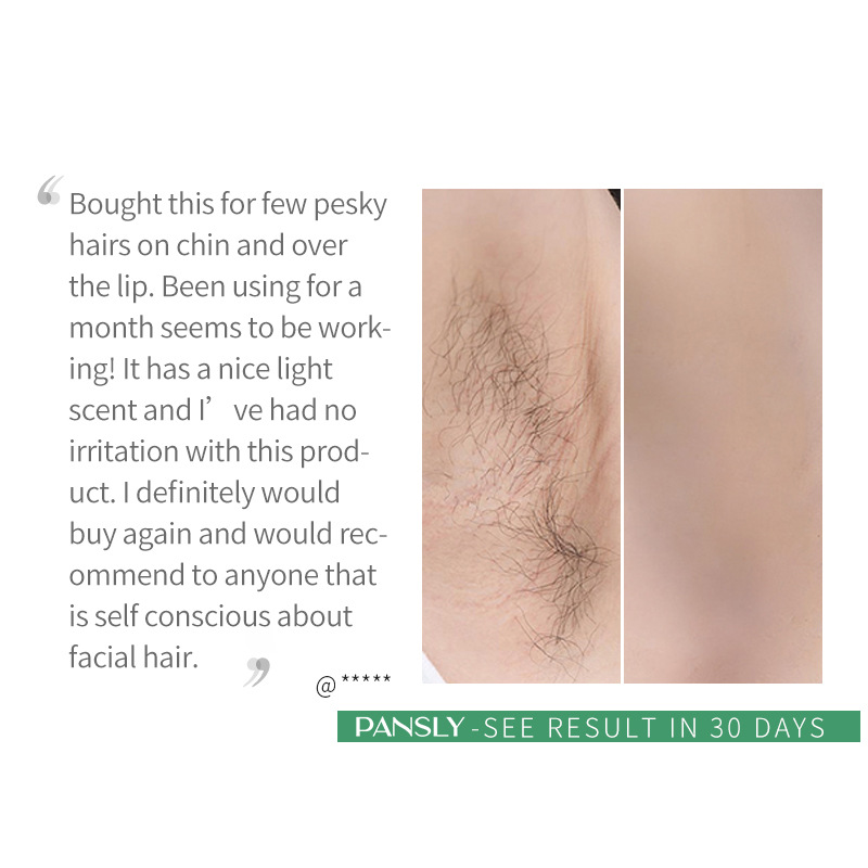 Hair Removal Cream For Underarm And Leg Hair Gentle Smoothing And Skin Softening Treatment 30ml