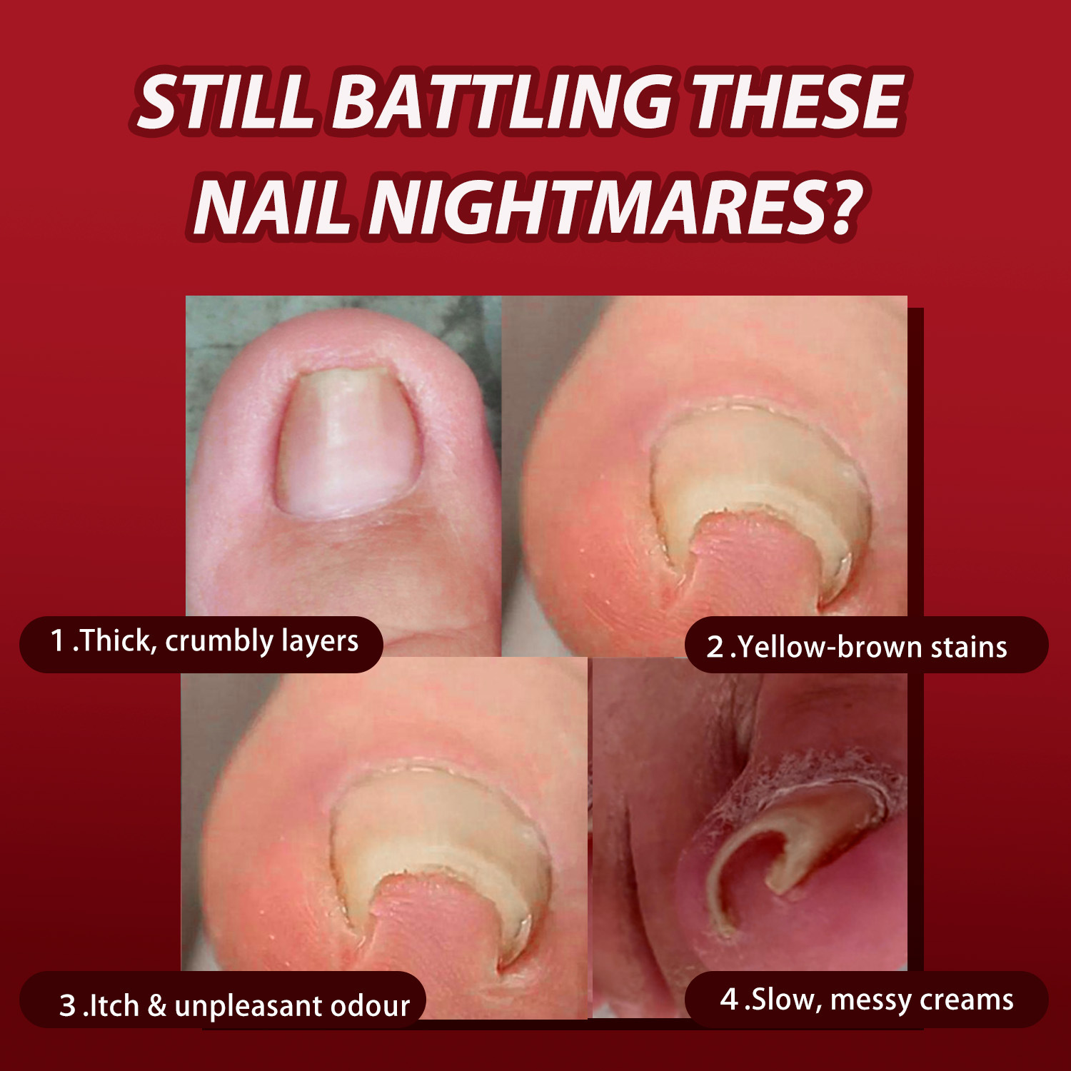 Nail Fungus Repair Patch For Toenail Care Softening Thickened Nails Daily Home Treatment 32 Patches