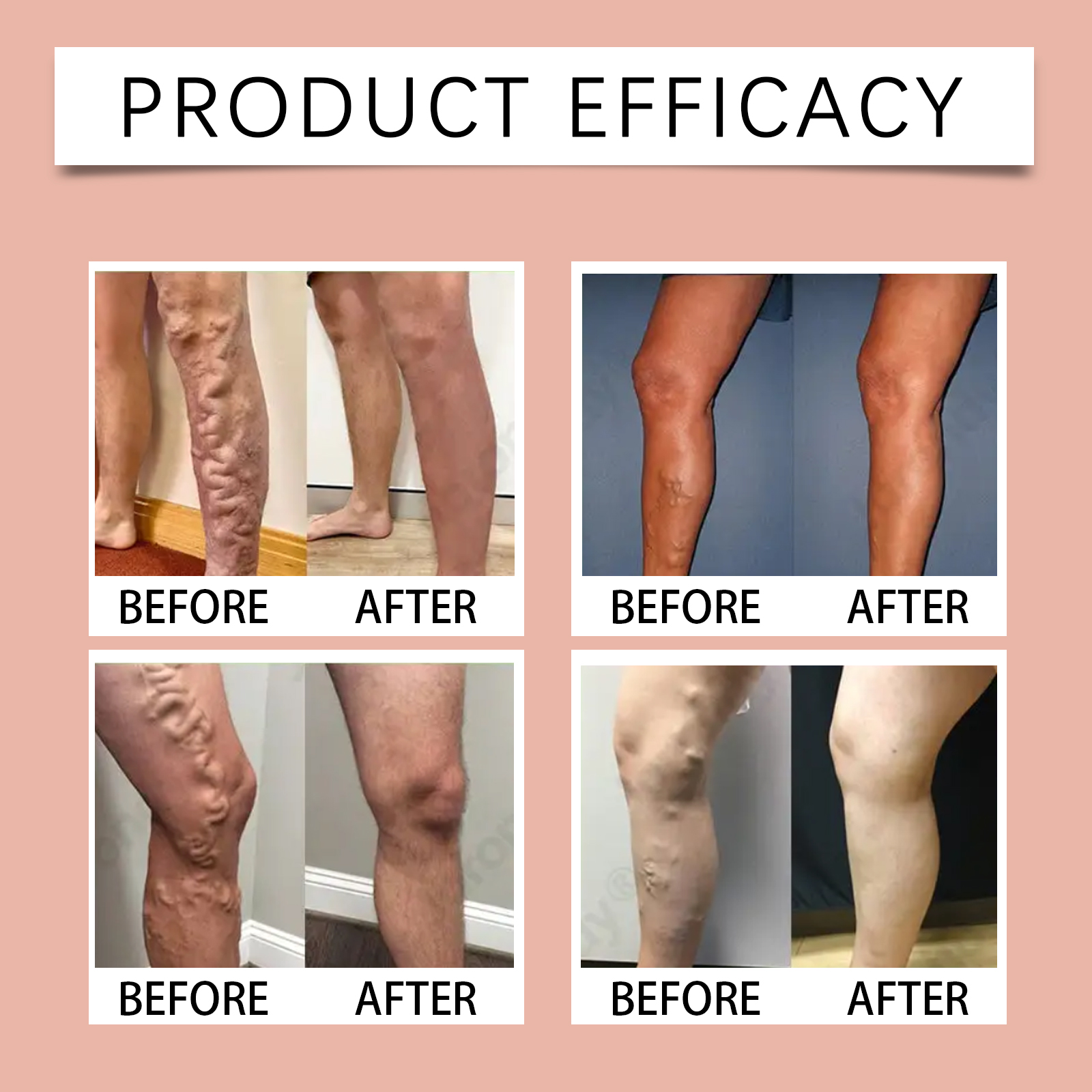 Leg Care Patch Mild Ingredients Refreshing Texture Soft Skin Friendly Portable Daily Leg Protection Care