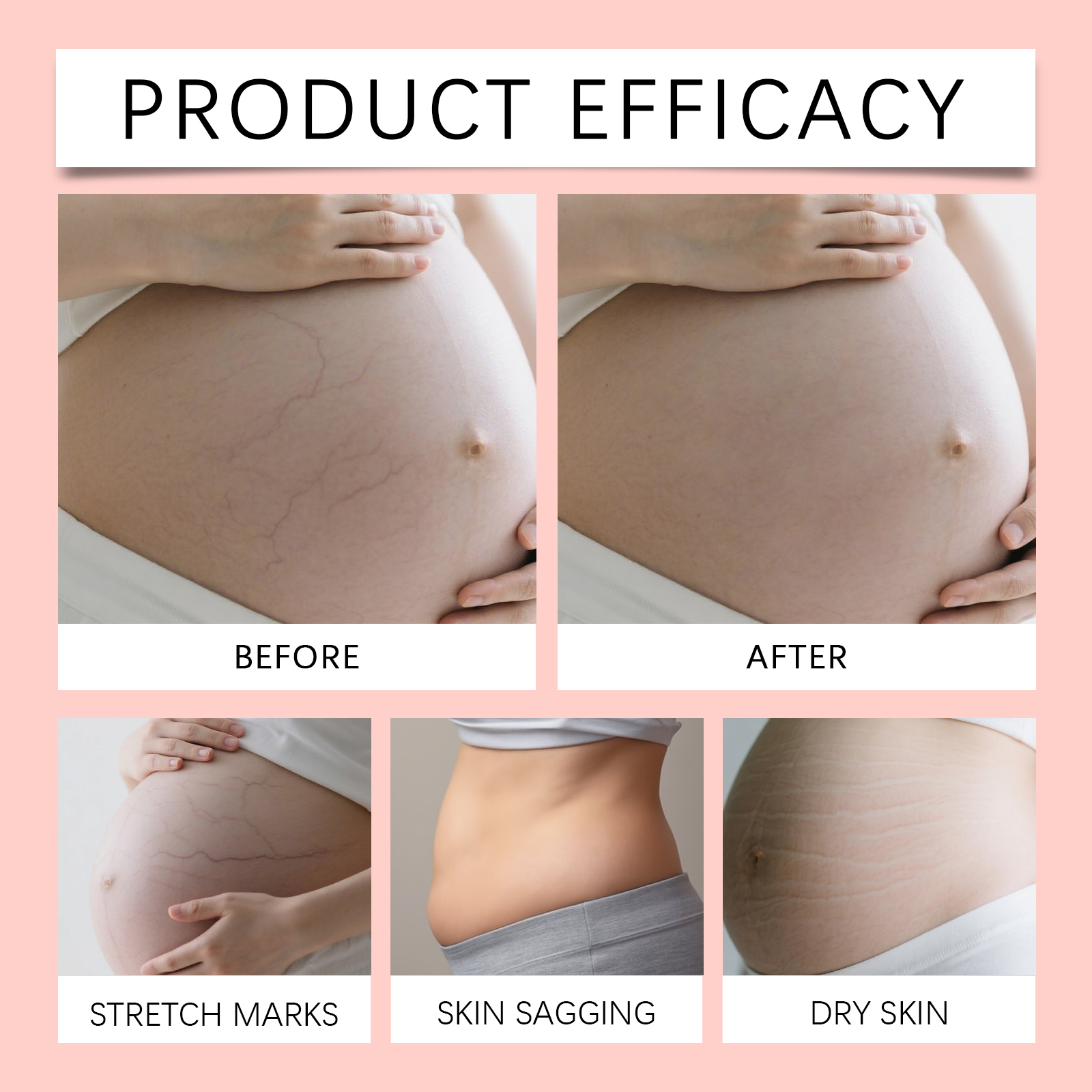 Skin Care Cream Nourishing Gentle Hydrating Refreshing Moisturizing Soften Female Abdominal Skin