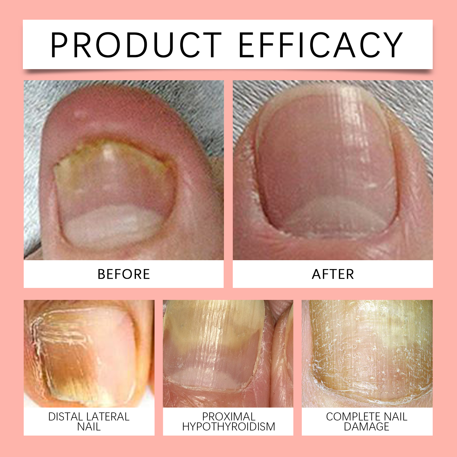 Nail Care Patch Gently Soften Damaged Nail Cuticle Moisturize Soft Maintain Nail Care