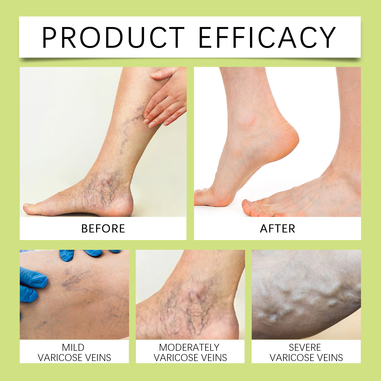 Leg Care Cream Gentle Care Ease Leg Discomfort Massage Daily External Use Care Ointment