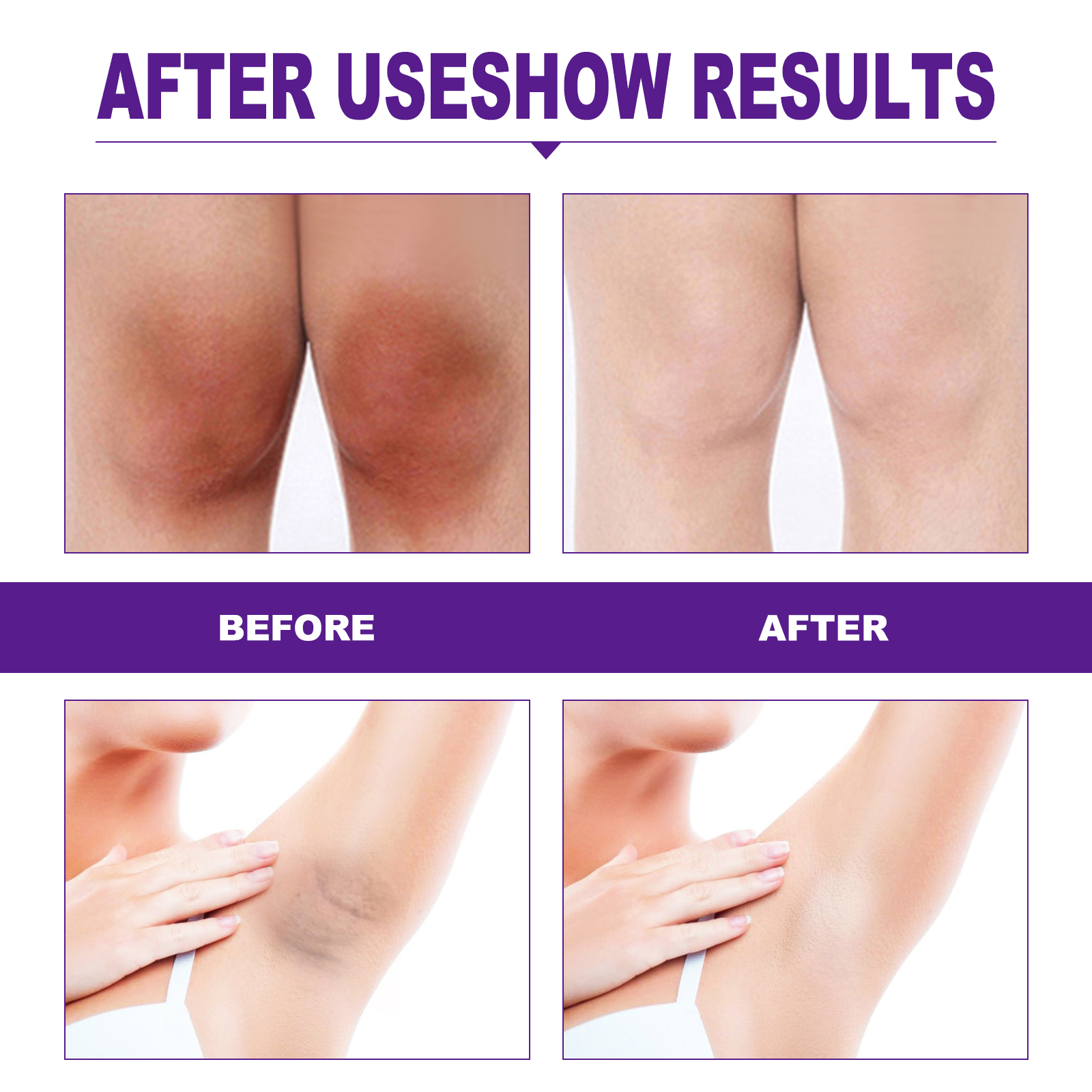 Body Care Cream Gentle Moisturizing For Underarms Knees Elbows Joints Daily Skin Nourishment