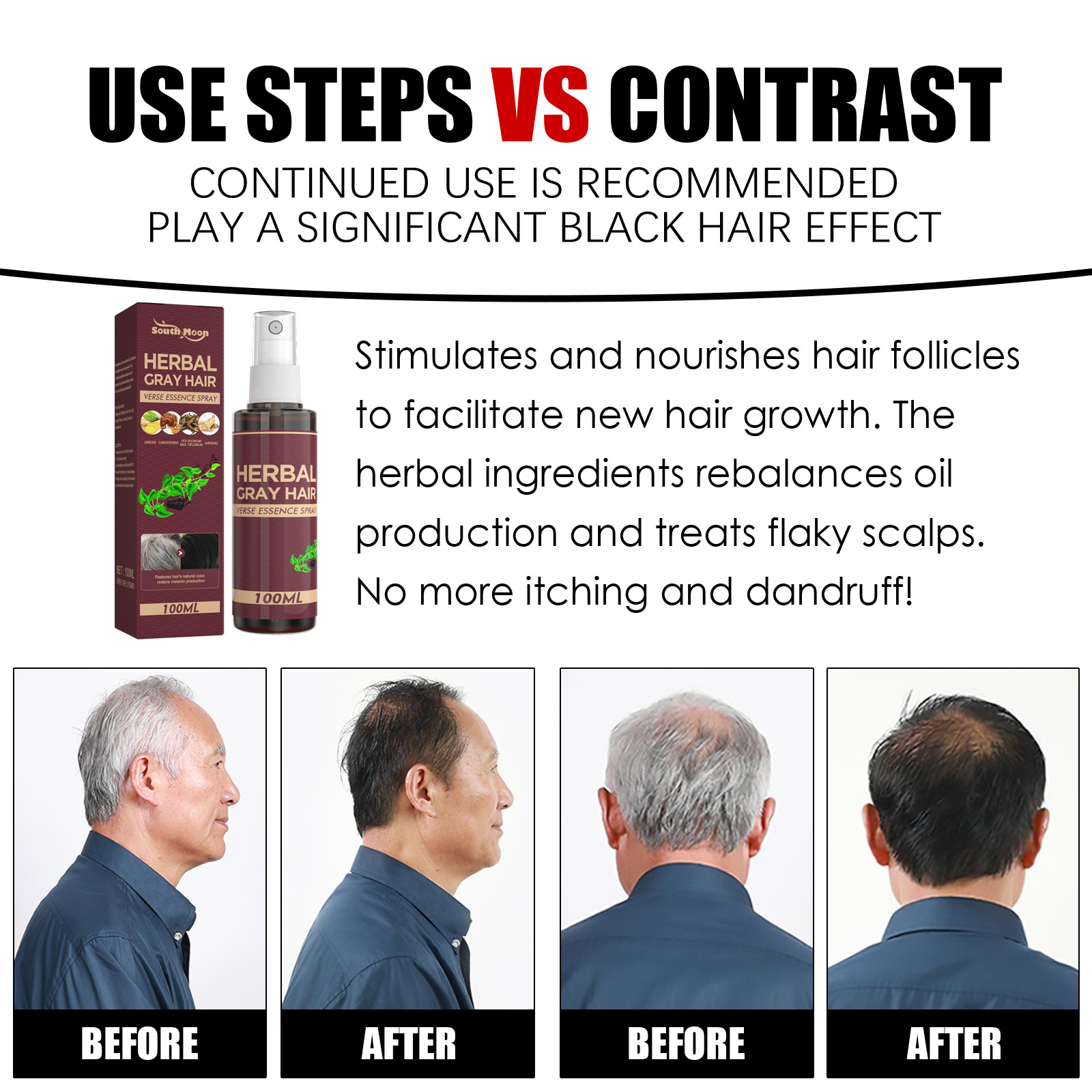 Herbal Black Hair Liquid Hair Darkening Spray Anti Gray Hair Scalp Nourish Spray Hair Treatment Polygonum Multiflorum Essence Bright Hair Care 100ml