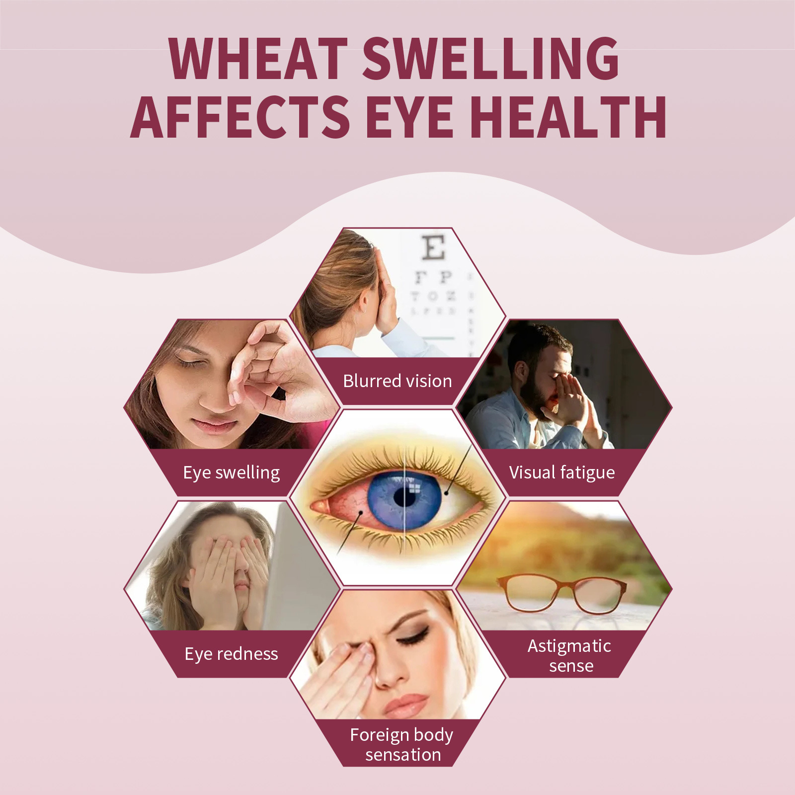 (1pc) Jaysuing Eye Swelling Relief Essence Relieve Fatigue Eyesight Remove Fat Granule Improve Redness Stye Eye Treatment Moisturizes Eye Serum 30ml