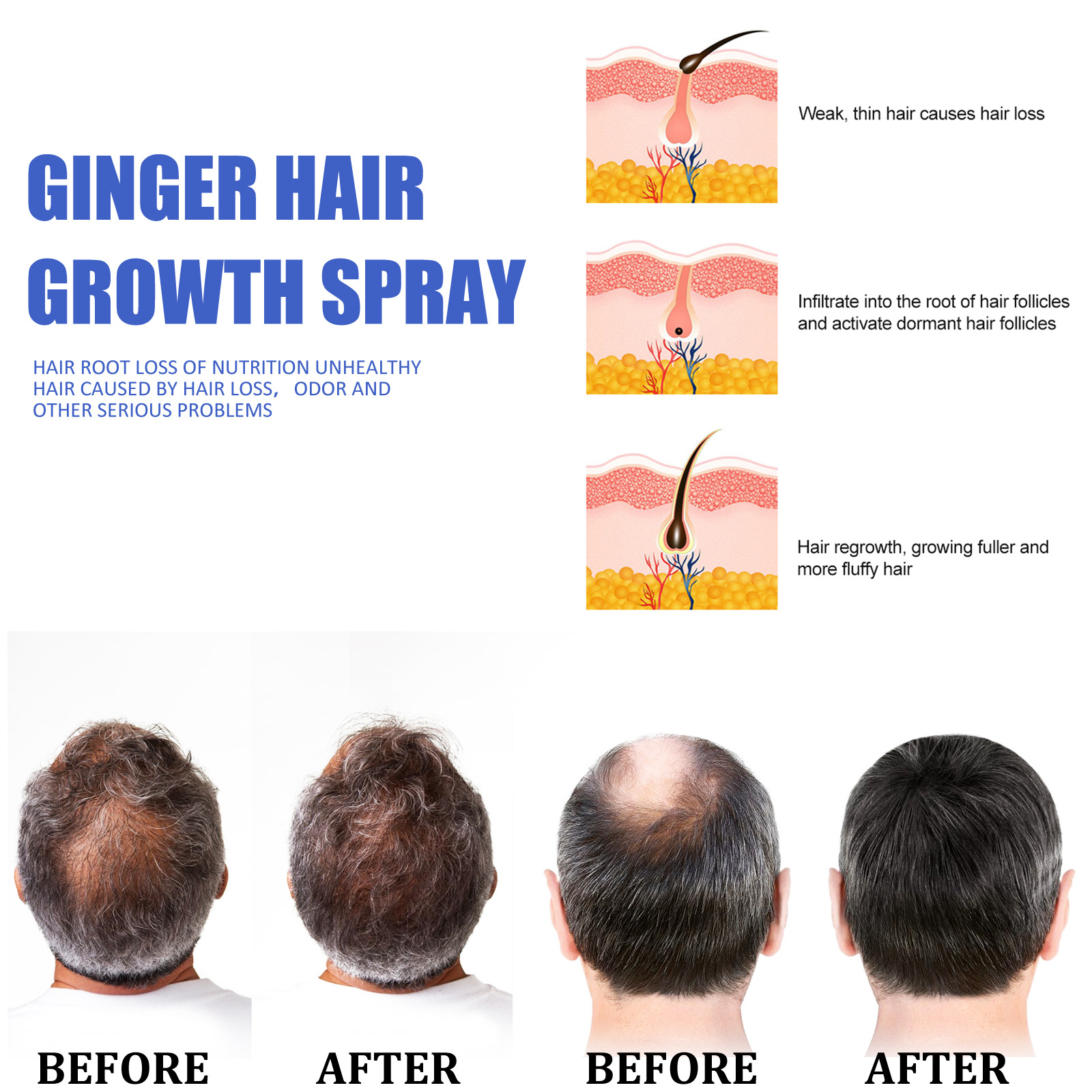 Ginger Hair Growth Spray Scalp Massage Hair Care Nutrient Solution 30ml