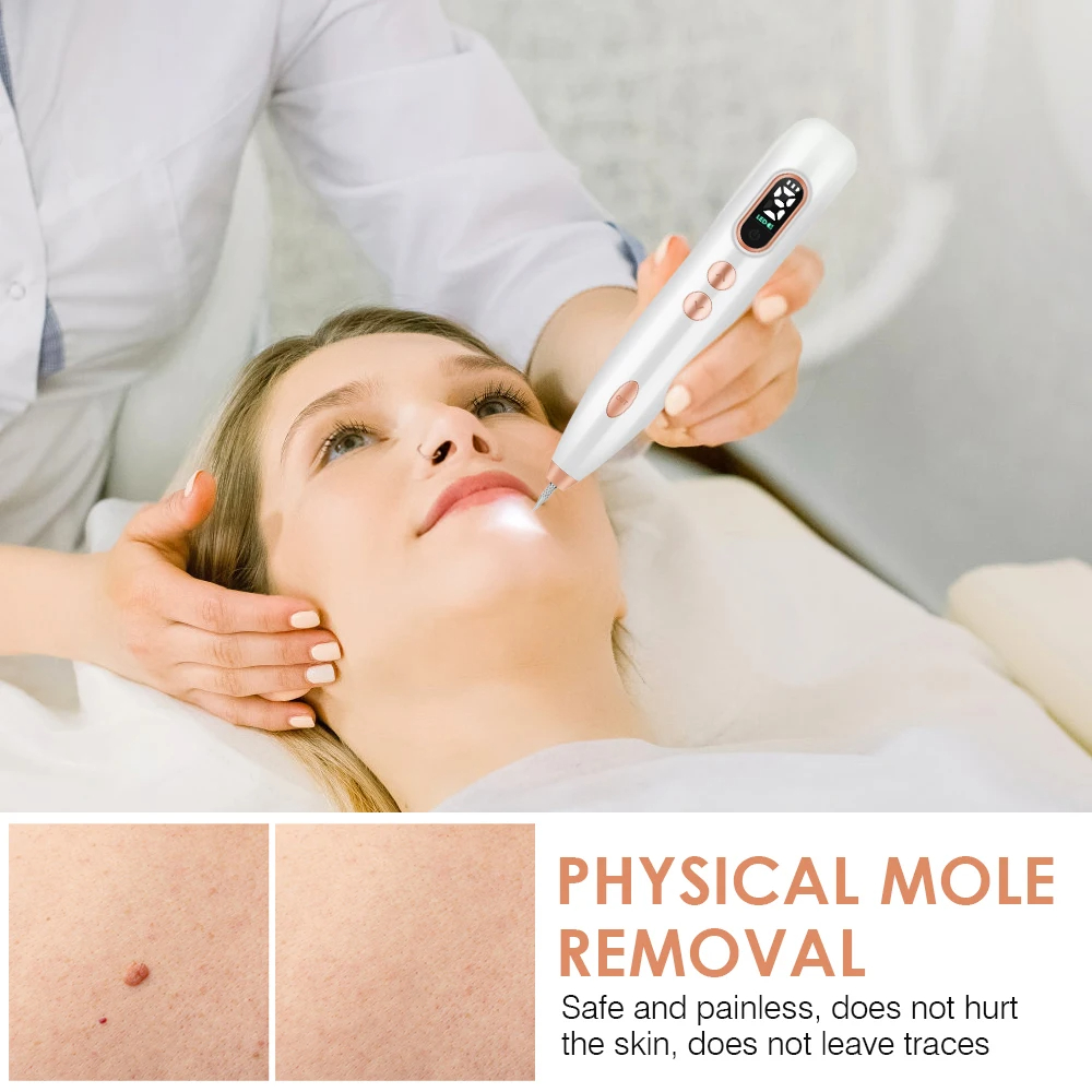 Rechargeable Plasma Pen Skin Tag Remover Mole Removal Tattoo Papilloma Wart Spots Dark Dpot Black Dot Nevus Freckle Flat Blemish Pimples Removal Pen