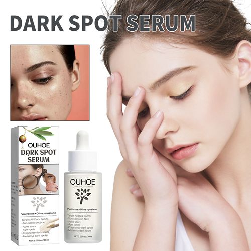OUHOE Whitening Serum Remove Dark Sp-ots Pigm-entation Melasma Ac-ne Ma-rks Anti-aging Lift Firm Brightening Tender Skin Serum