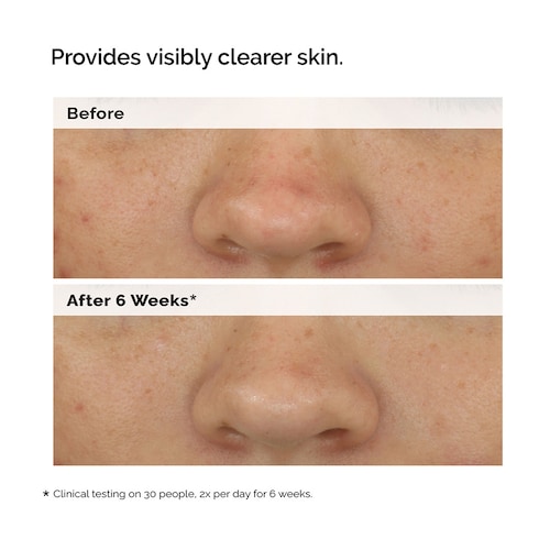 The Ordinary Balancing Clarifying Serum for Blemish Prone Skin 30ml