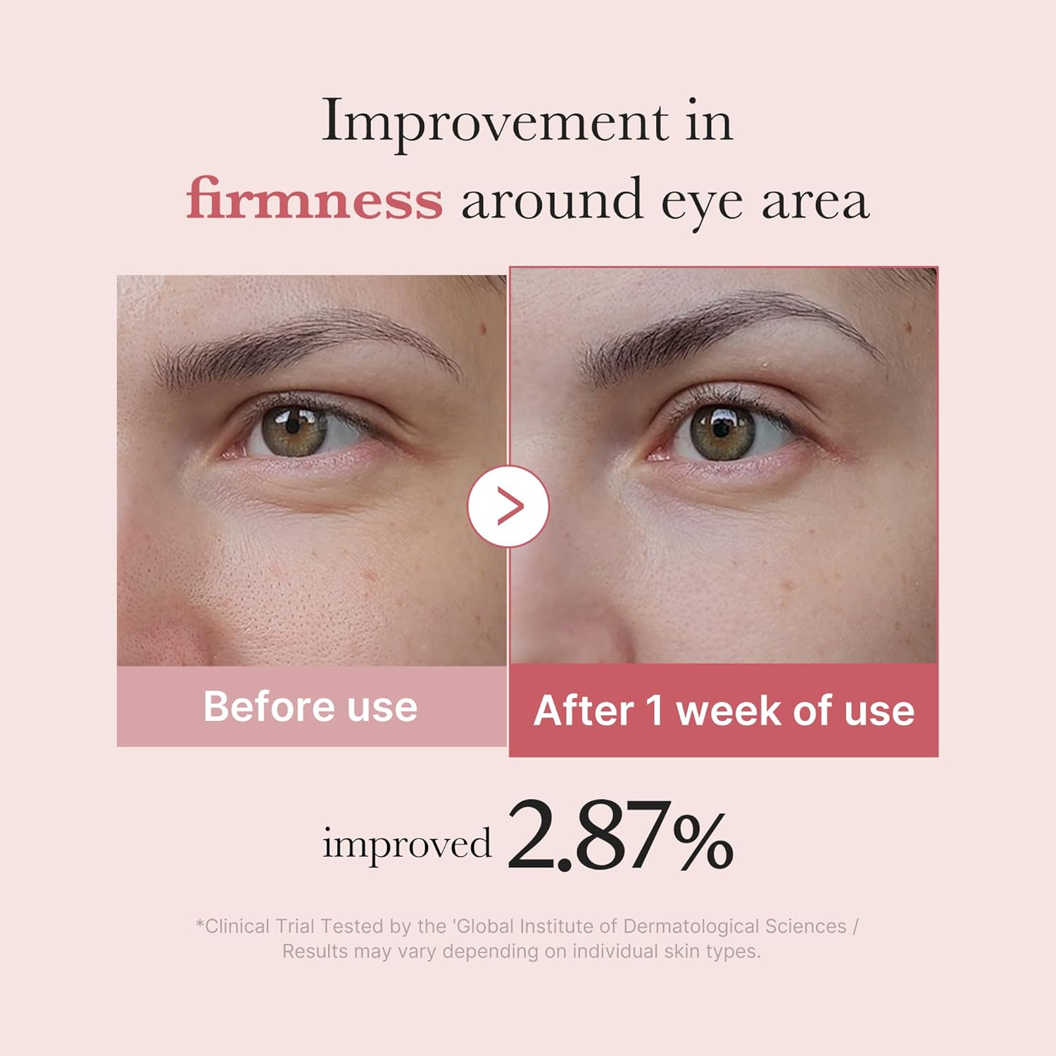 medicube Salmon DNA PDRN Pink Peptide Eye Serum with Niacinamide and 99 Percent Purity Retinol for Fine Lines Uneven Skin Color Korean Skincare 30ml