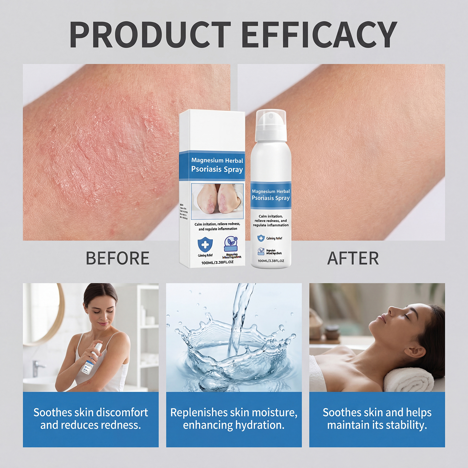 Magnesium Skin Care Spray Mild Ingredients Hydrate Skin Soft Refreshing Non Sticky Daily Use Treatment Lotion