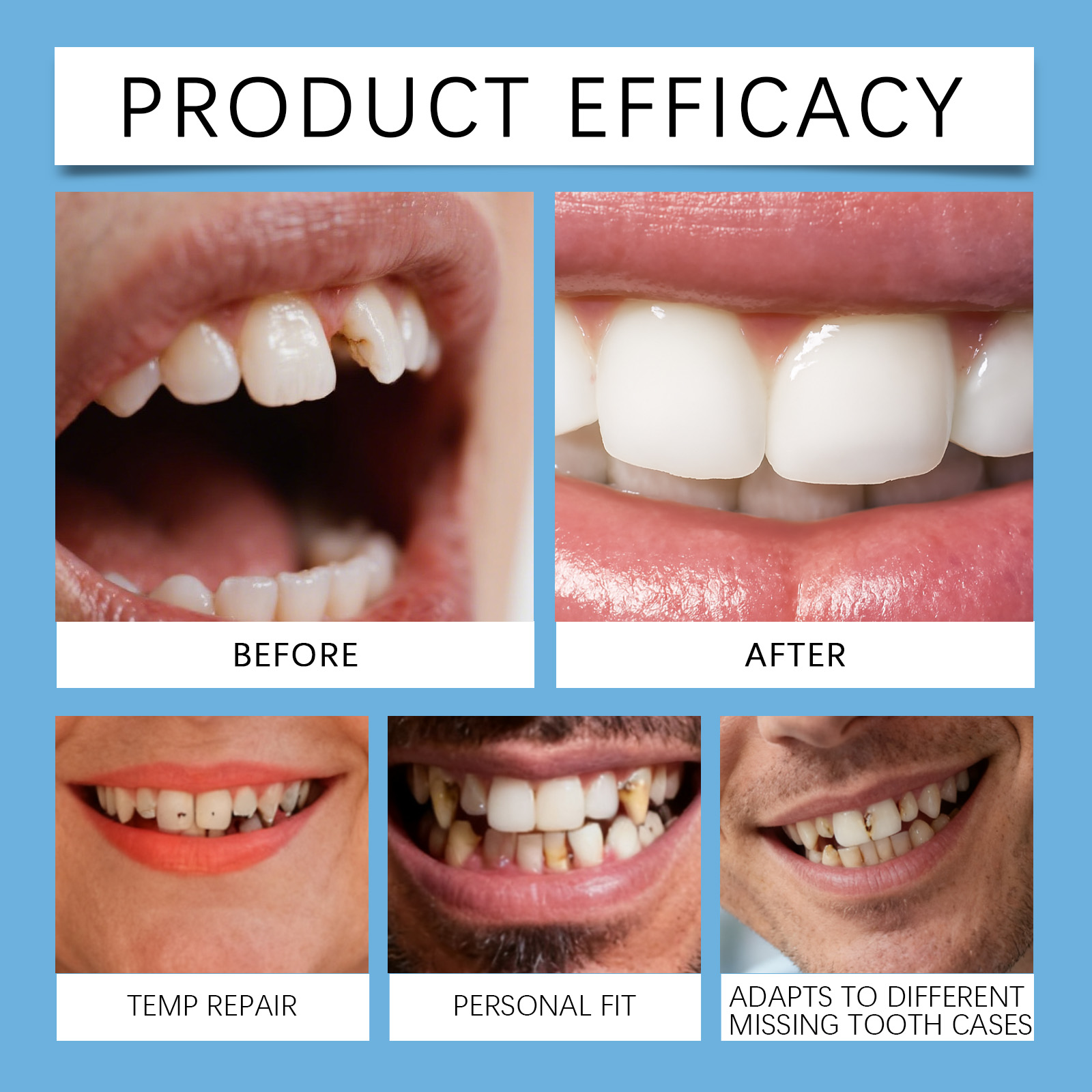 Solid Dental Gum Plastic Adjustable Comfortable Fit Natural Look Beautiful Modification Oral Temporary False Teeth Decoration