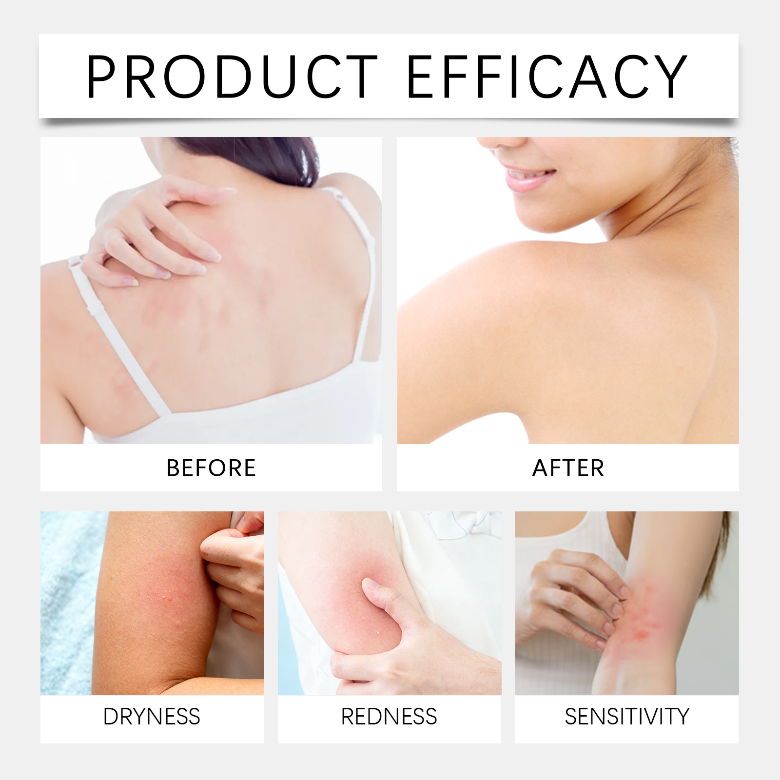 Skin Care Cream Infuses Plant Essences Gentle Skin Compatible Hydrate Moisturize Smooth Texture Light Non Greasy