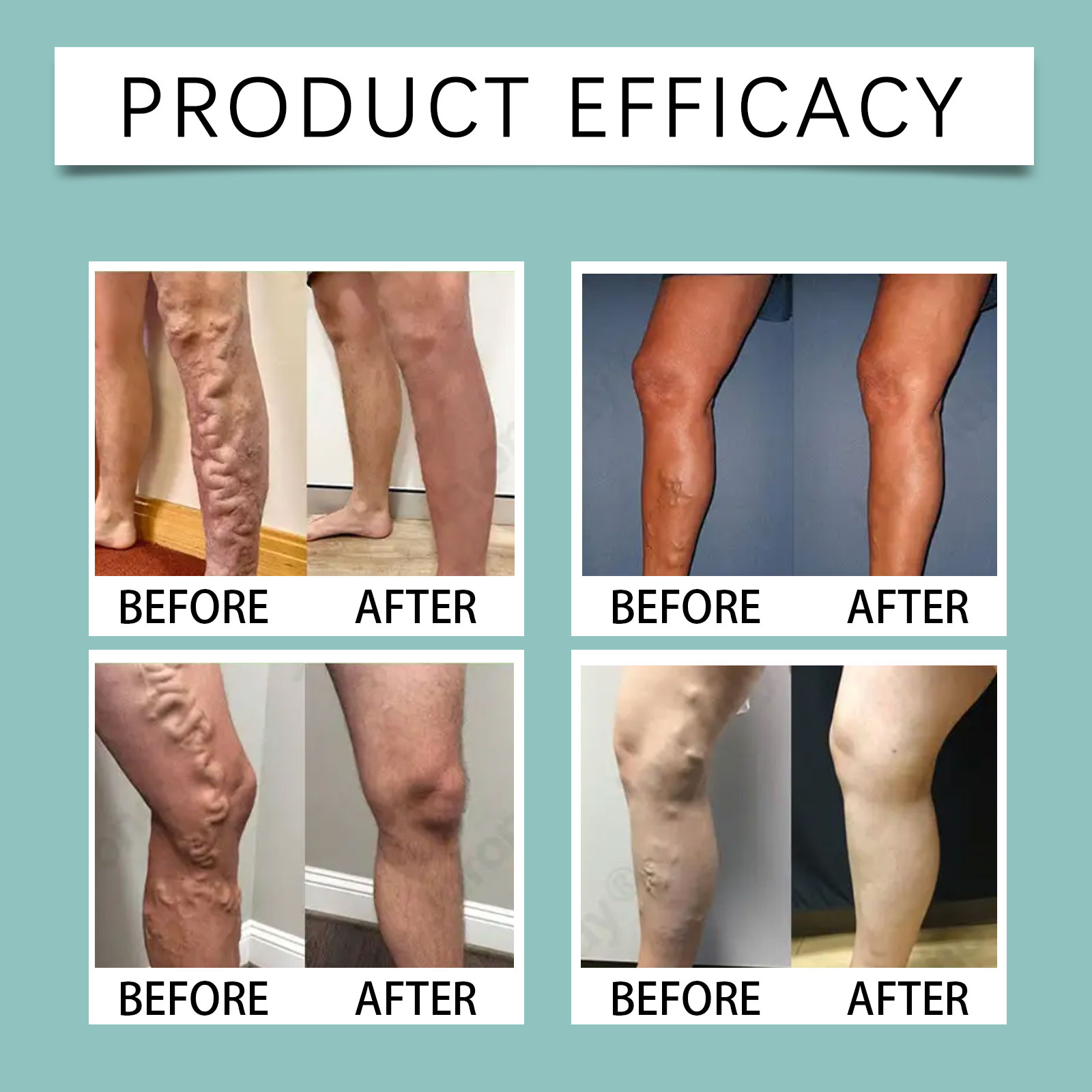Leg Soothing Care Patch Mild Massage Leg Skin Light Breathable Comfort Convenient Gentle Nursing