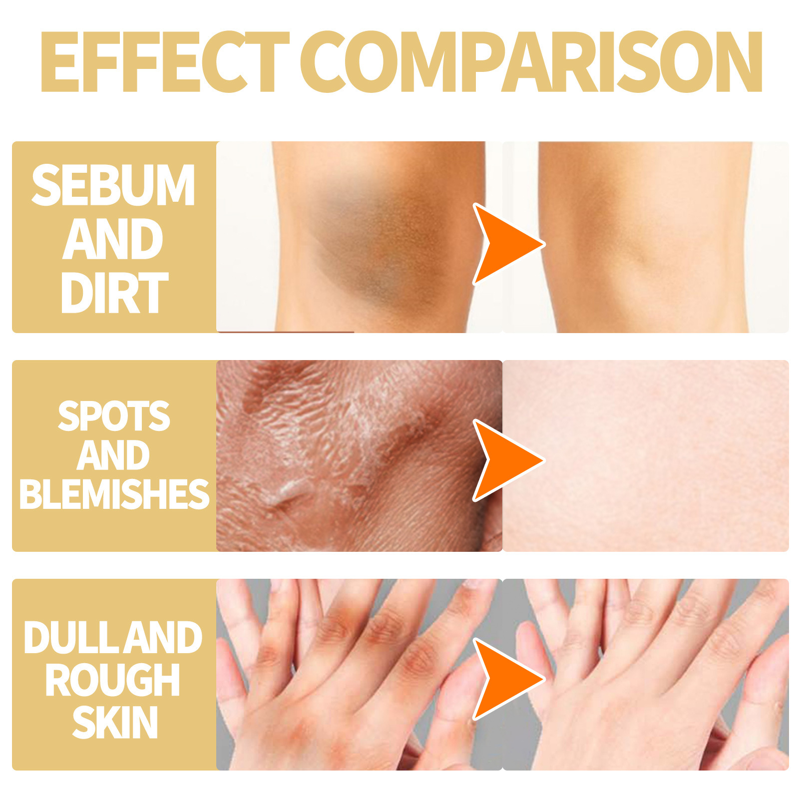 Whitening Peeling Oil for Face Natural Super Strength Yellow Peeling Solution Oil Body Exfoliation Dark Skin Remove Brightening Whitening Skin Care