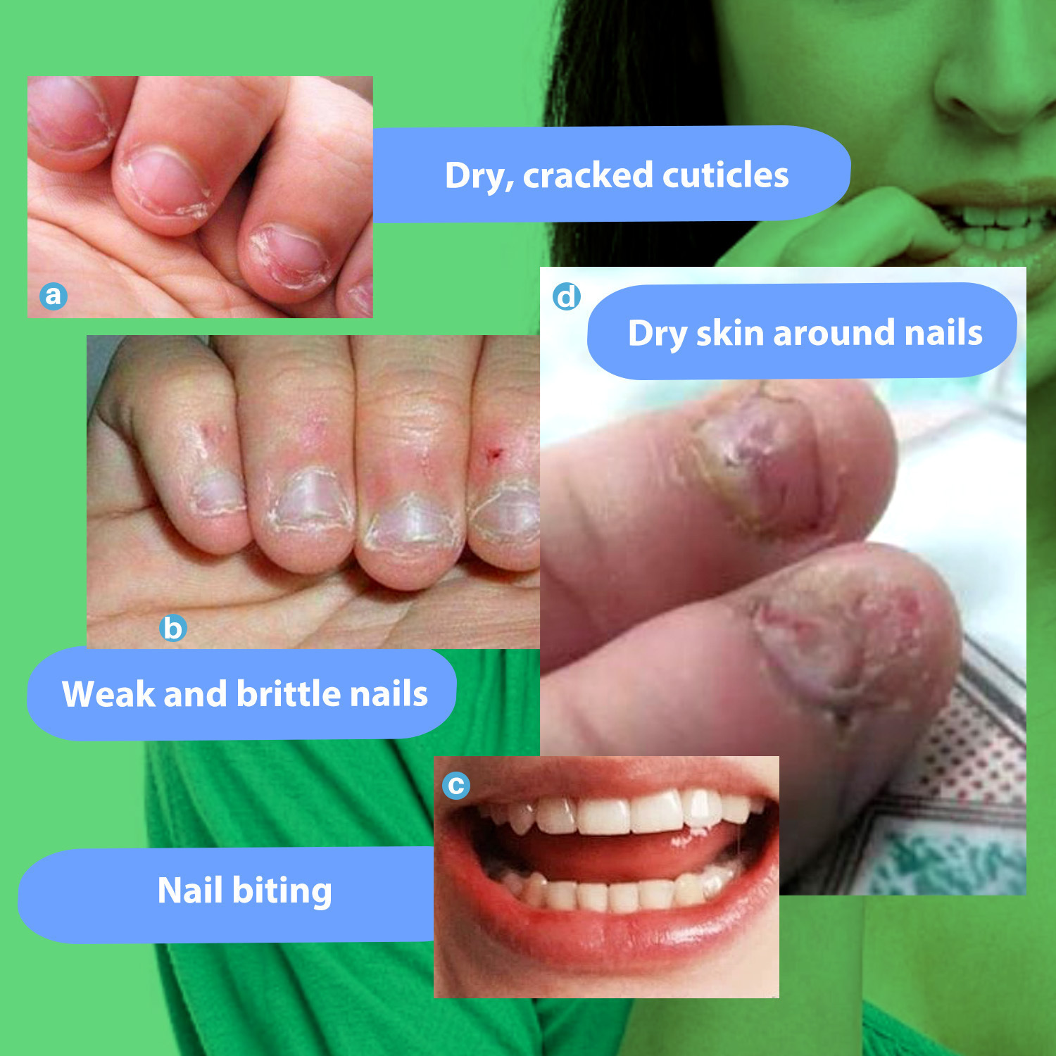 Anti Nail Biting Liquid For Cuticle Care Bitter Taste Deterrent And Nail Strengthening Treatment