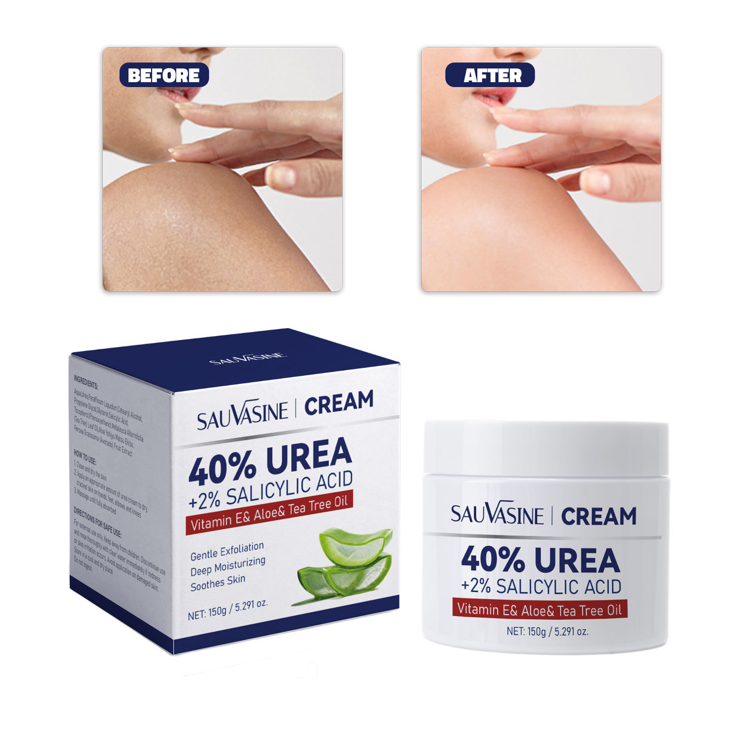 40 Percent Urea Face Cream Moisturizing Vitamin E Exfoliating For Dry Skin Renewal And Daily Hydrating Care