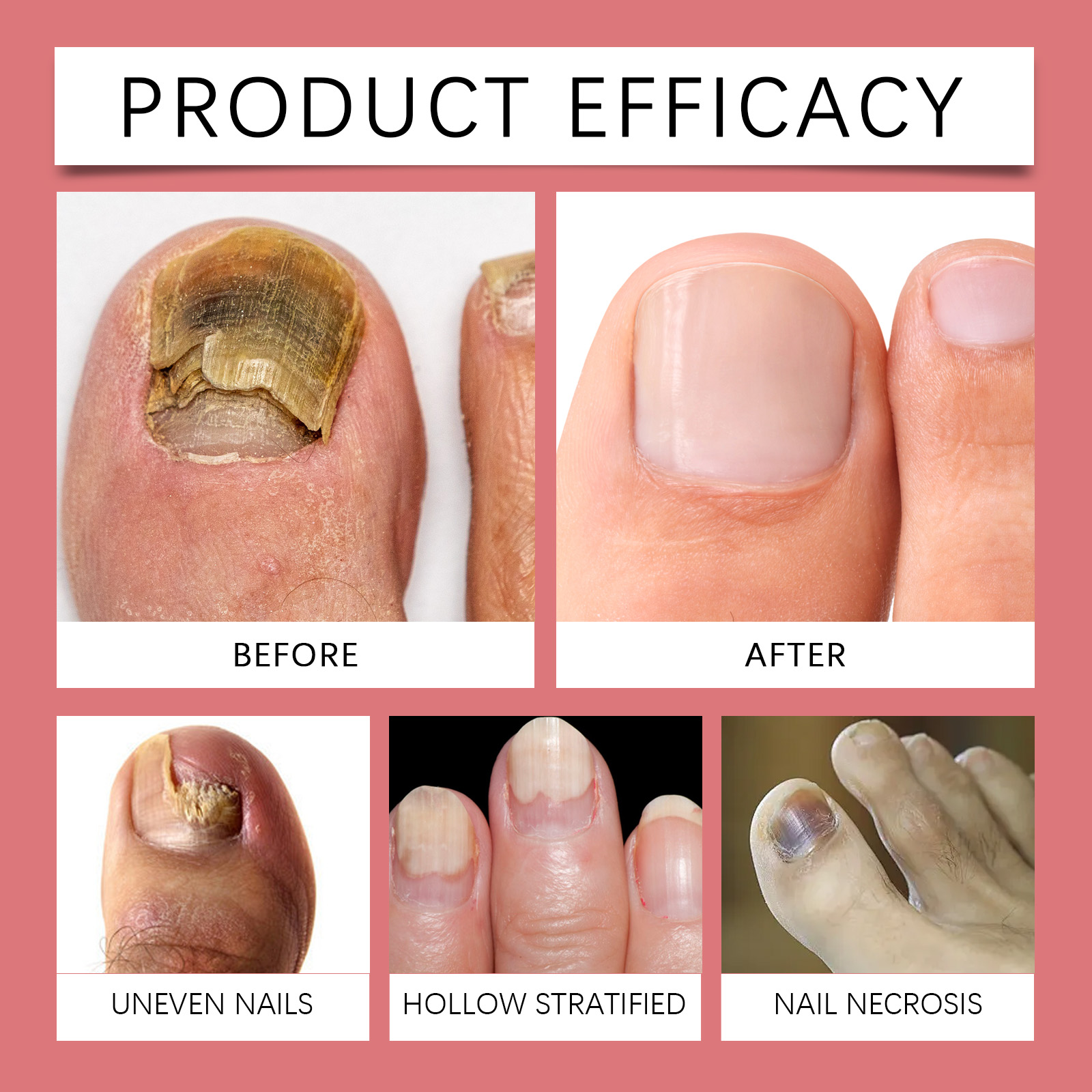 Toenail Care Drops Mild Gentle Formula Moisturizing Comfort Shiny Nail Surround Daily Protect Toenail Skin