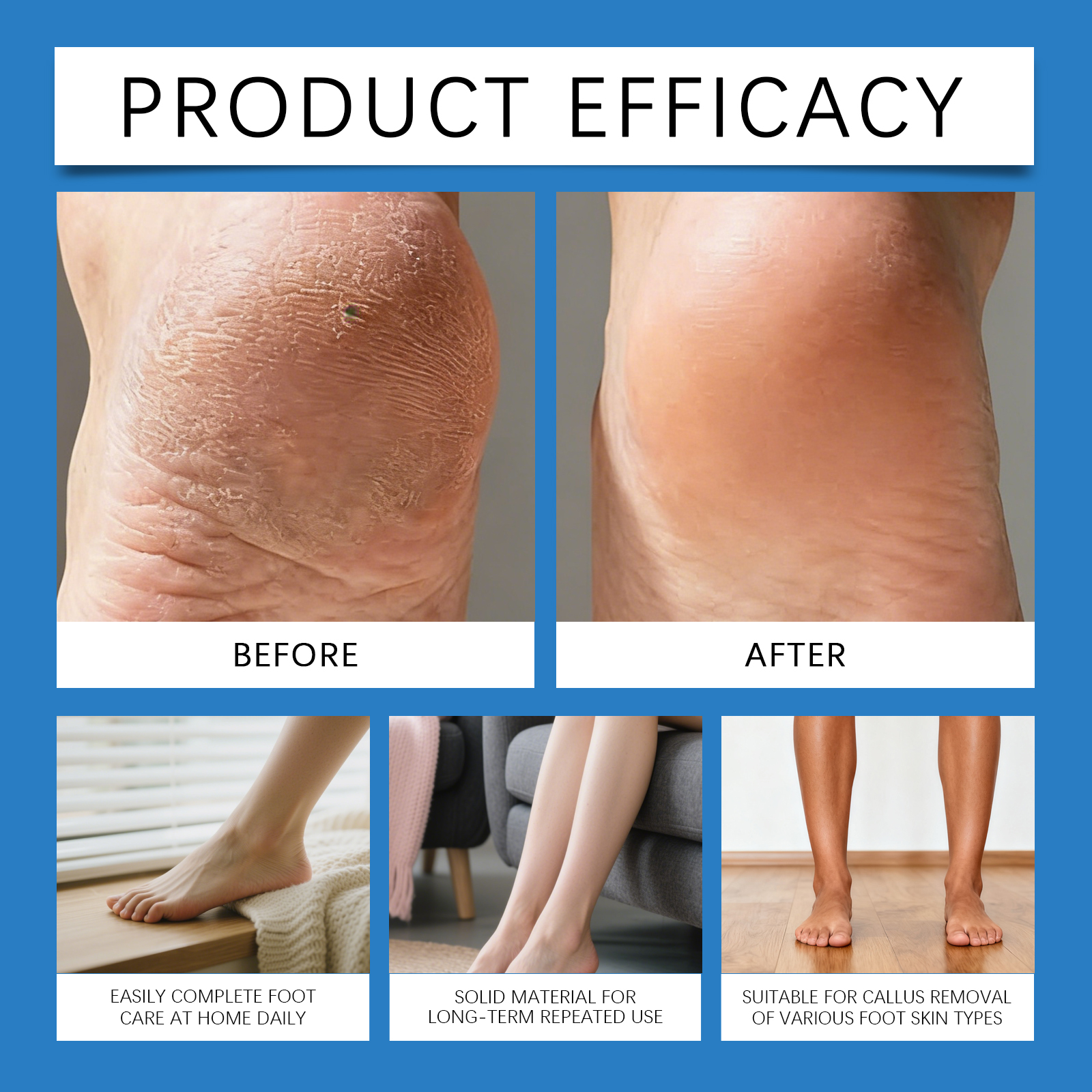 Portable Callus Remover Mild Clean Leg Skin Dead Cells Care Smooth Complexion Anti Slip Easy Operation
