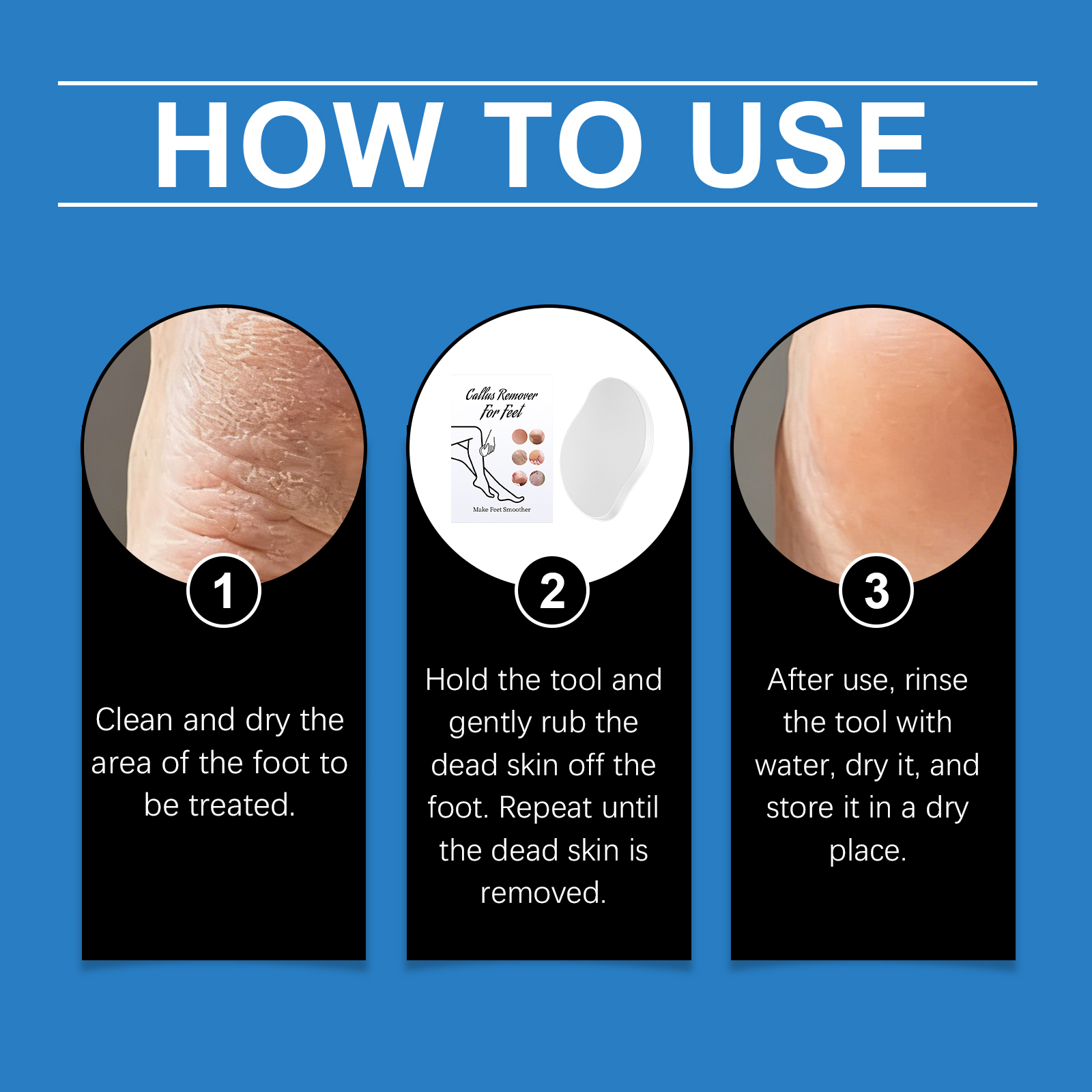 Portable Callus Remover Mild Clean Leg Skin Dead Cells Care Smooth Complexion Anti Slip Easy Operation