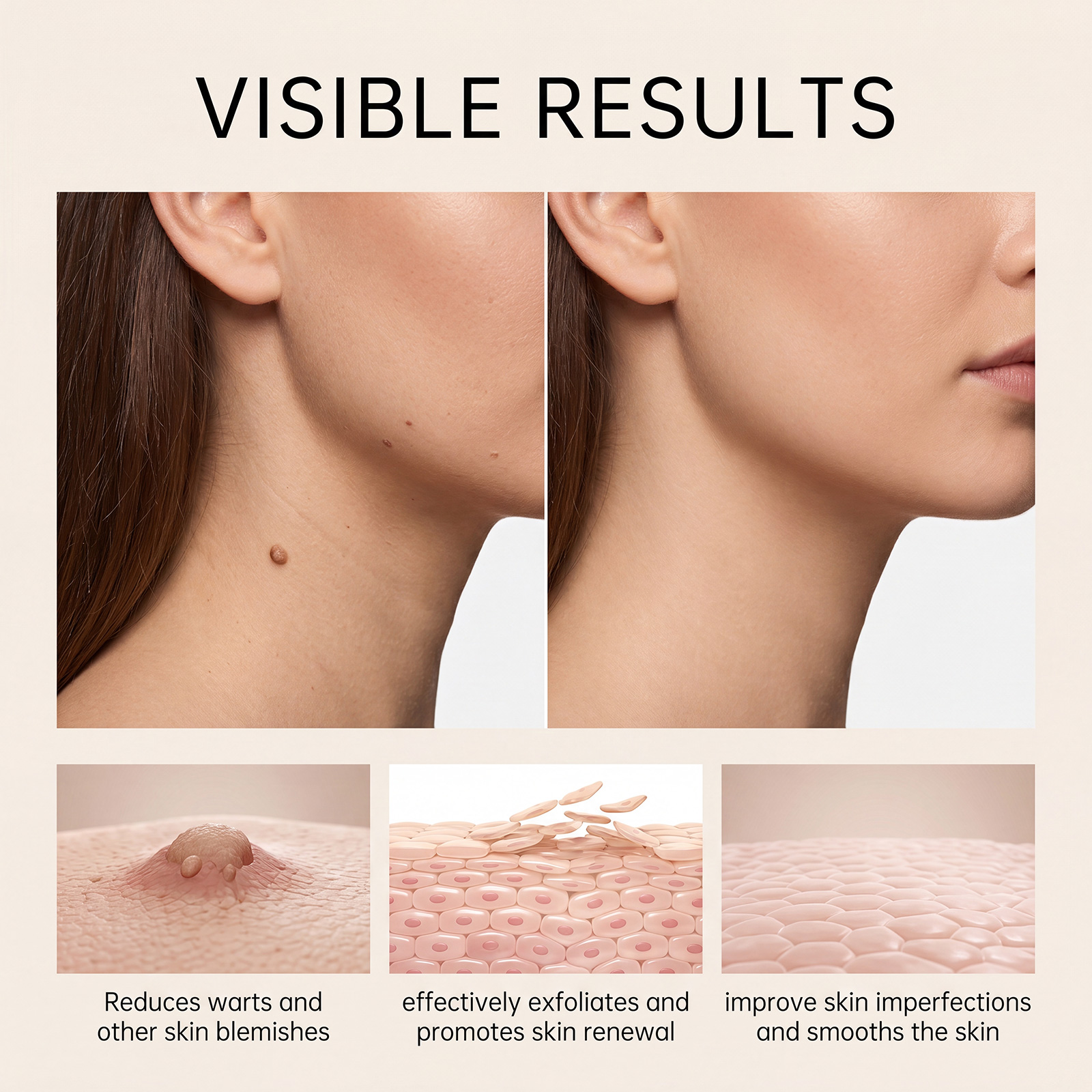 Clean Skin Care Patch Gentle Nourish Clean Complexion Fresh Comfort Invisible Daily Facial Acne Treatment Pad