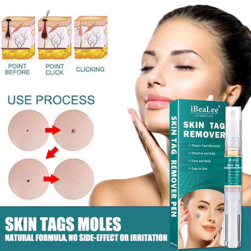 iBeaLee Skin Tag Remover Tagwort Removal 7 Days 5ml