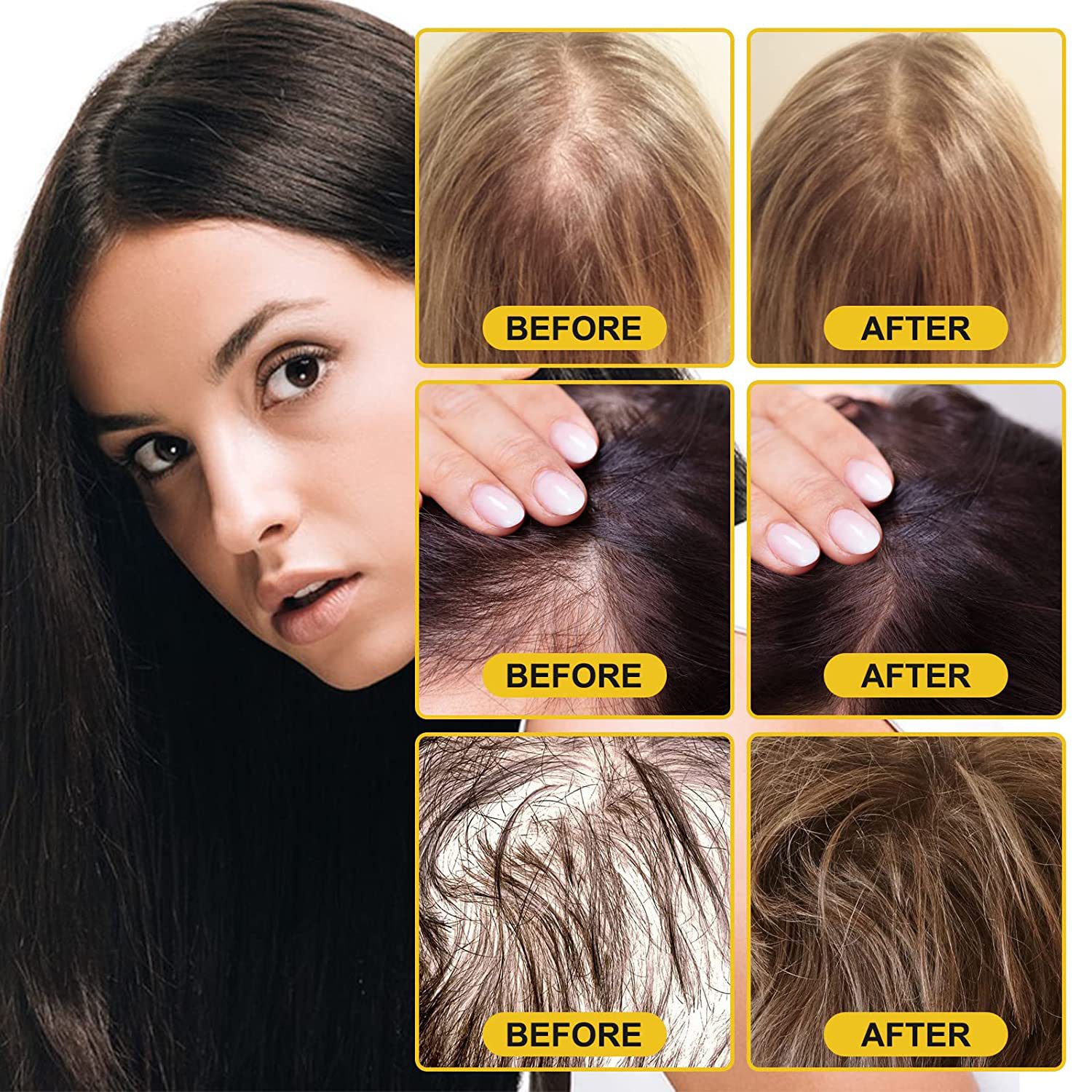 iBeaLee Hair Growth Serum Rice Water for Hair Growth Hair Loss Scalp Treatments Nourish Hair Care for Thicker Longer Fuller Healthier Hair