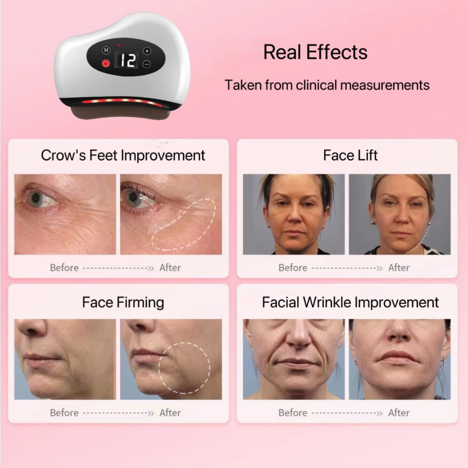 (White) Vibration Scraping Board Facial Gua Sha Electric Stone Lifting Massager Remover Nasolabial Folds Anti Cellulite Anti-Aging Beauty Health Tool