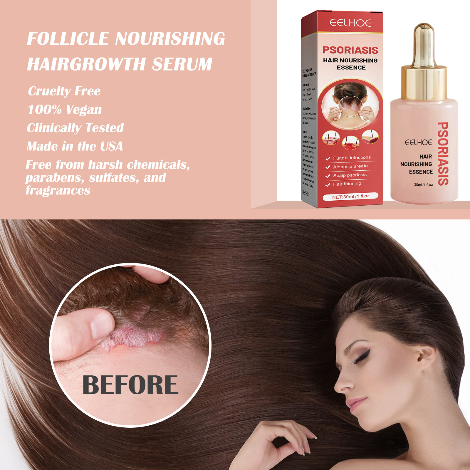 Hair Serum Psoriasis Dandruff Treatment for Scalp Oil Anti Itching Follicle Booster Stimulator Moisturizes Smoothing Nourishing