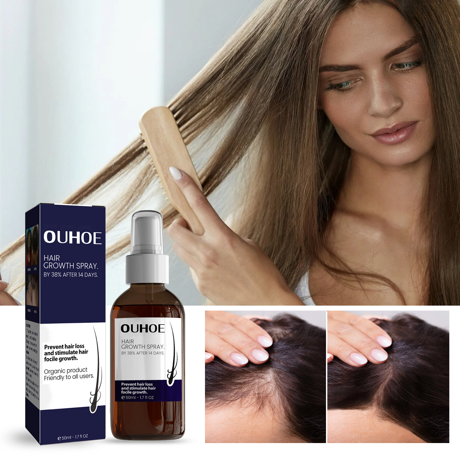 Hair Lotion Serum Essence Oil Hair Applicator Hair Growth Treatment Hair Anti Hair Loss Spray Stripping and Repairing Damaged Hair Roots for Men Women