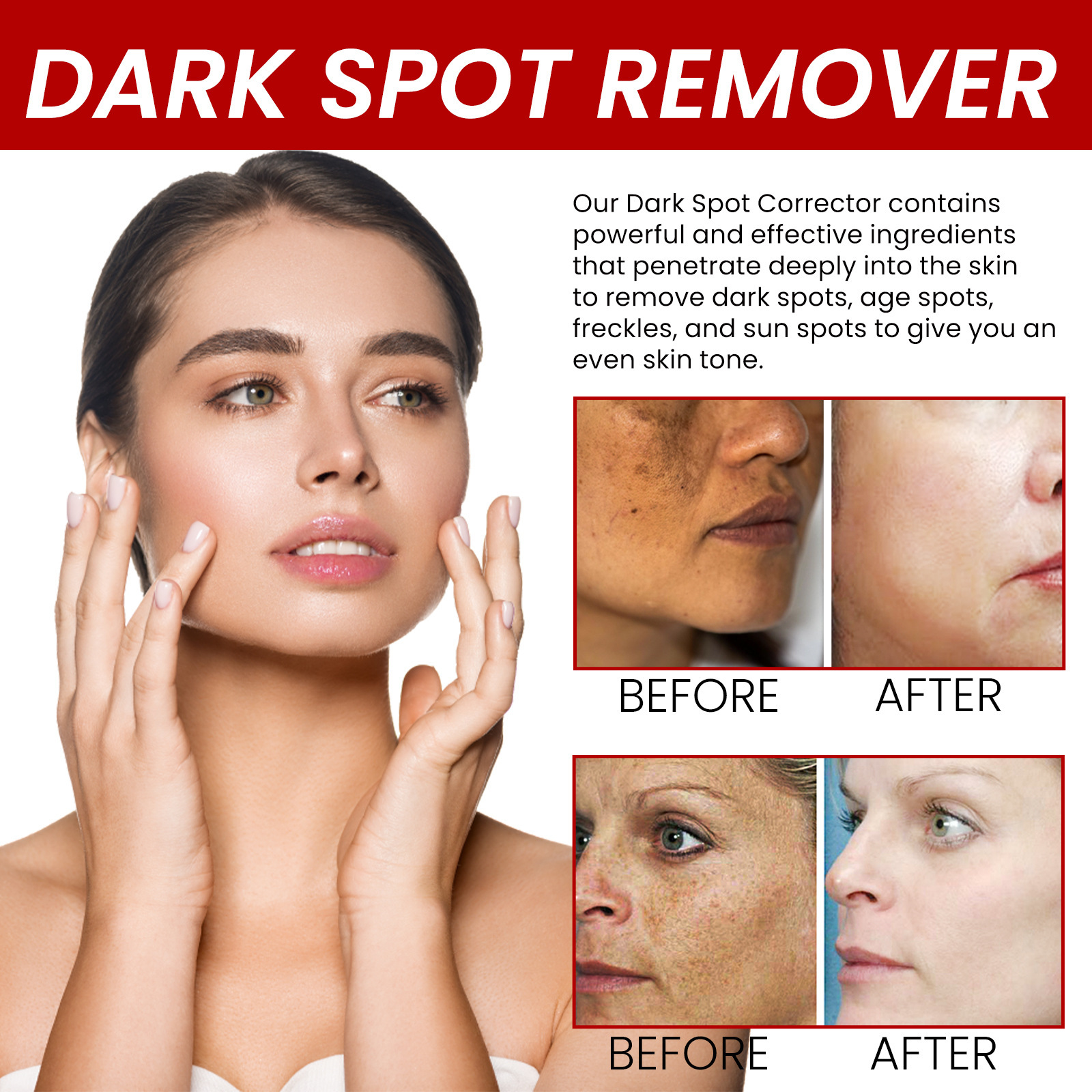 Whitening and Freckle Removing Cream Remove  Dark Spot Melanin Melasma Lighten Brighten Smooth Skin Care